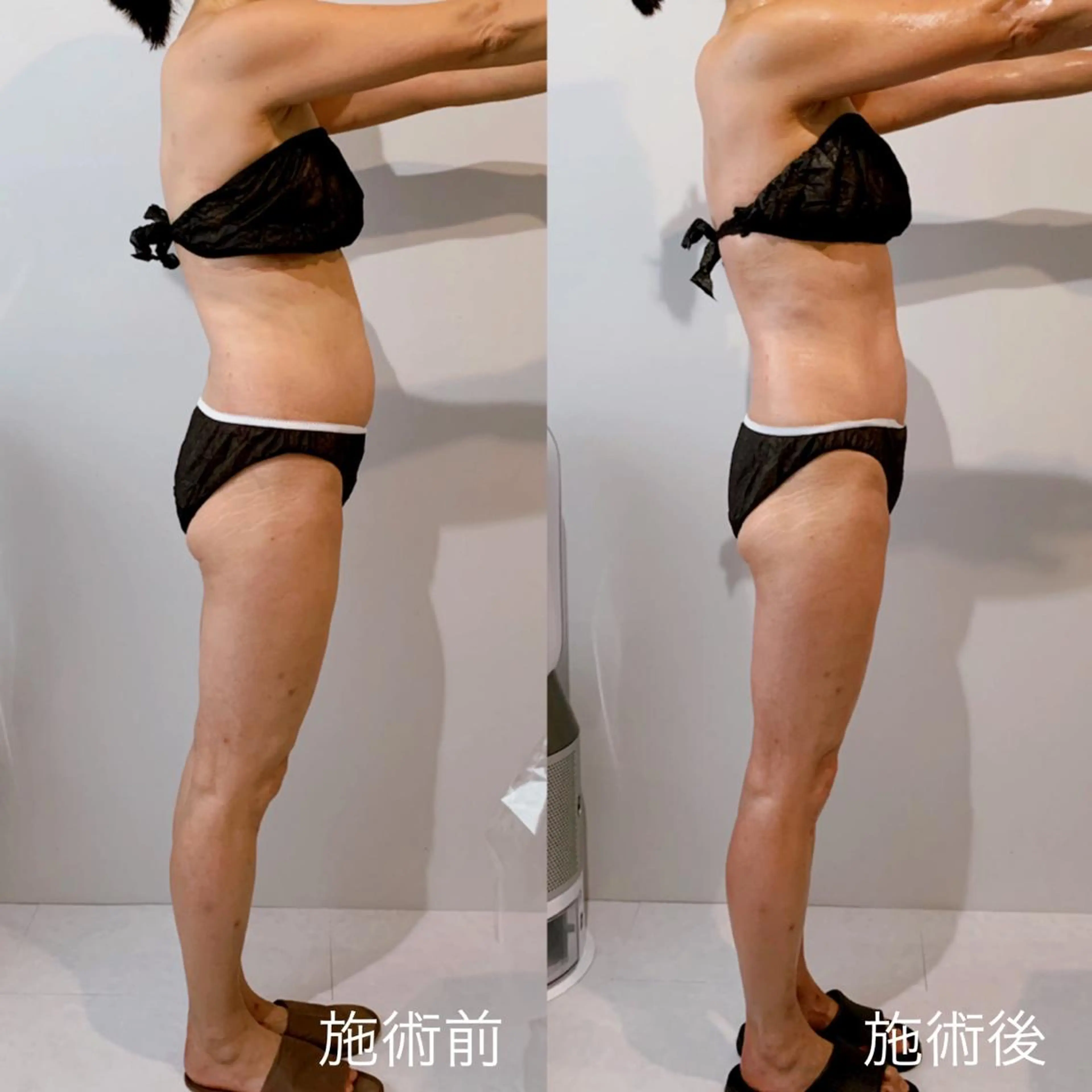 エステ リラク ボディメンテナンス shinomaのエステ・リラクイメージ