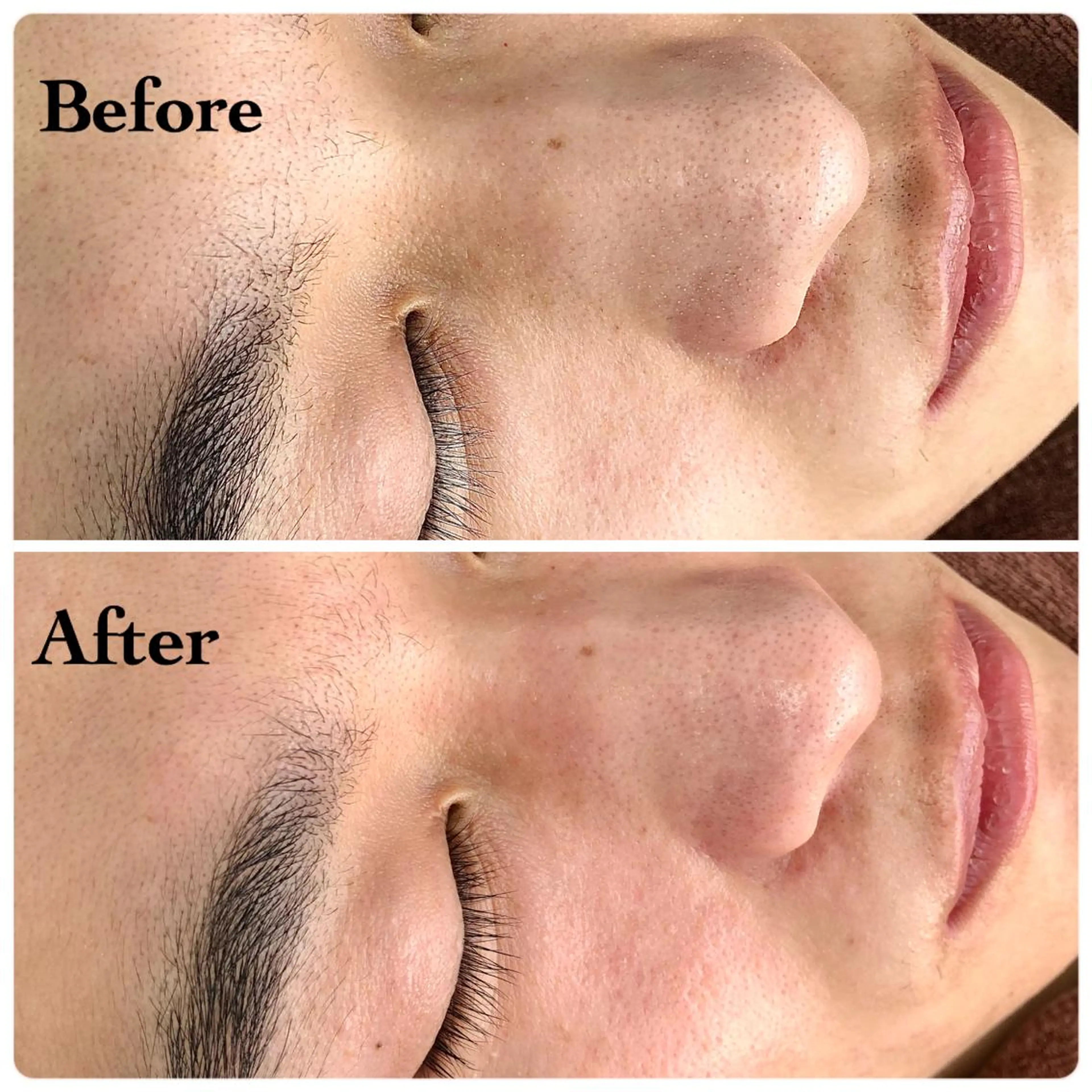 メンズ 医療提携美容サロン Beatriceのエステ・リラクイメージ