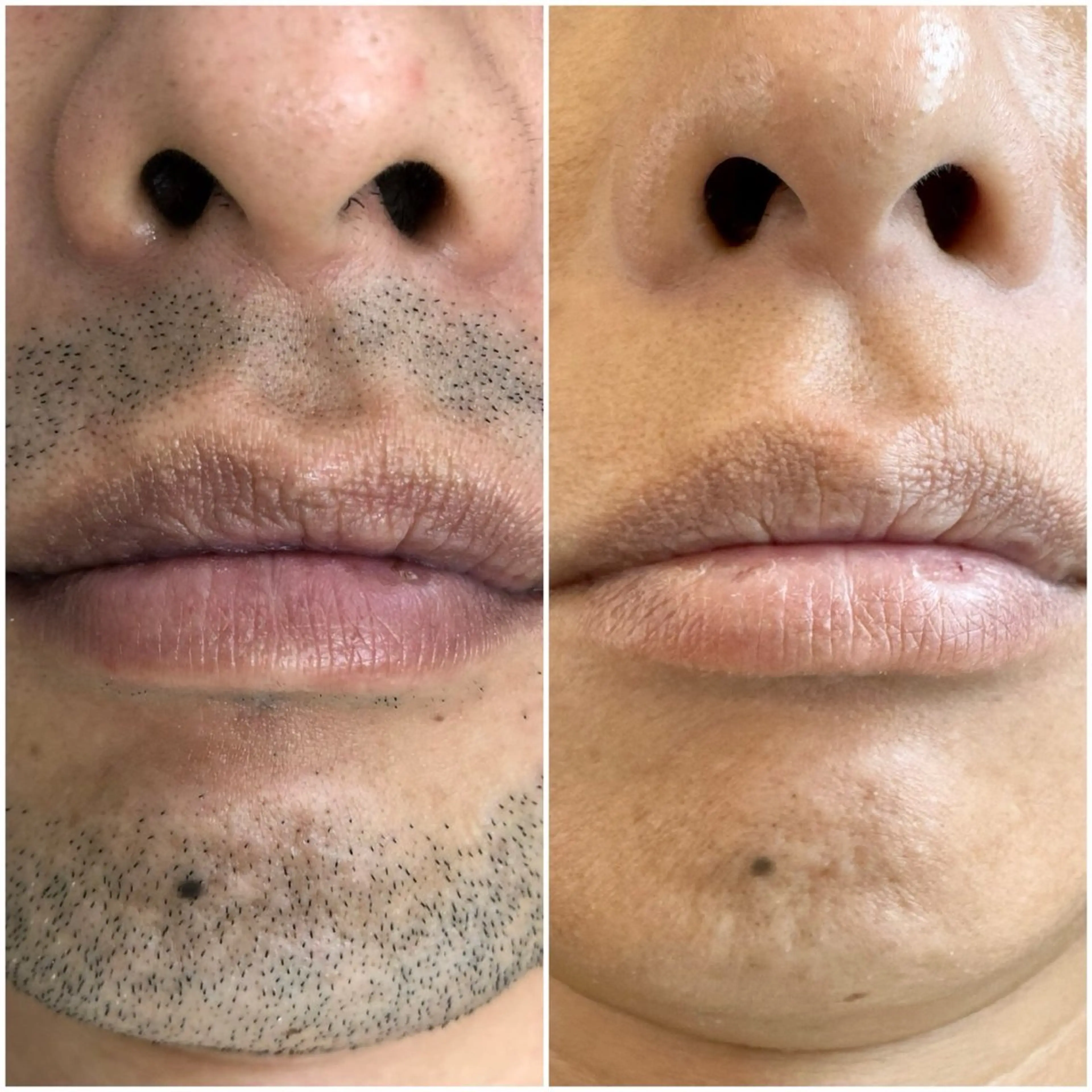 脱毛専門サロンElixir加須店所属・脱毛専門サロン Elixir　加須店のエステ・リラクイメージ