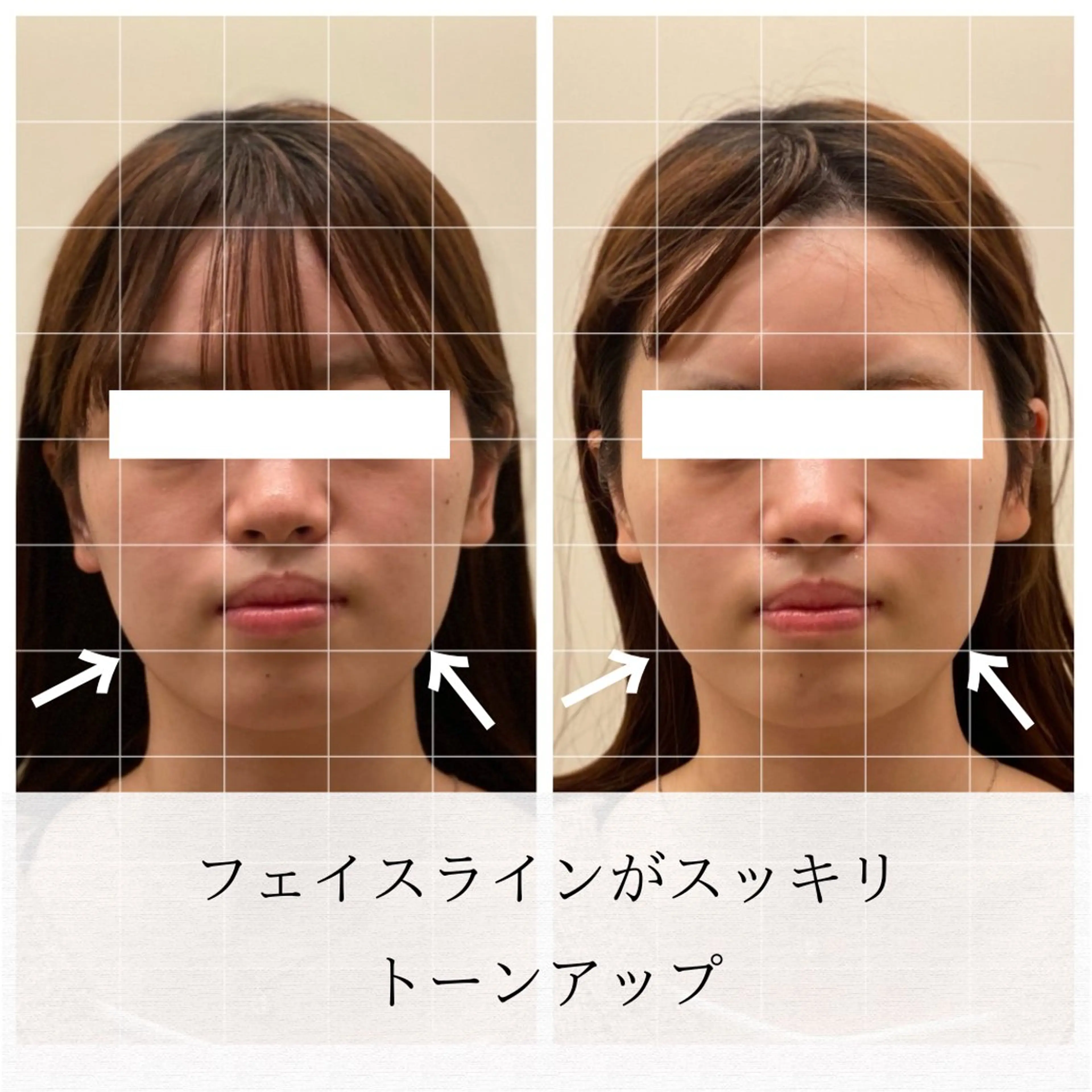 美容鍼/ヘッドスパ/ 💎さかもとのエステ・リラクイメージ