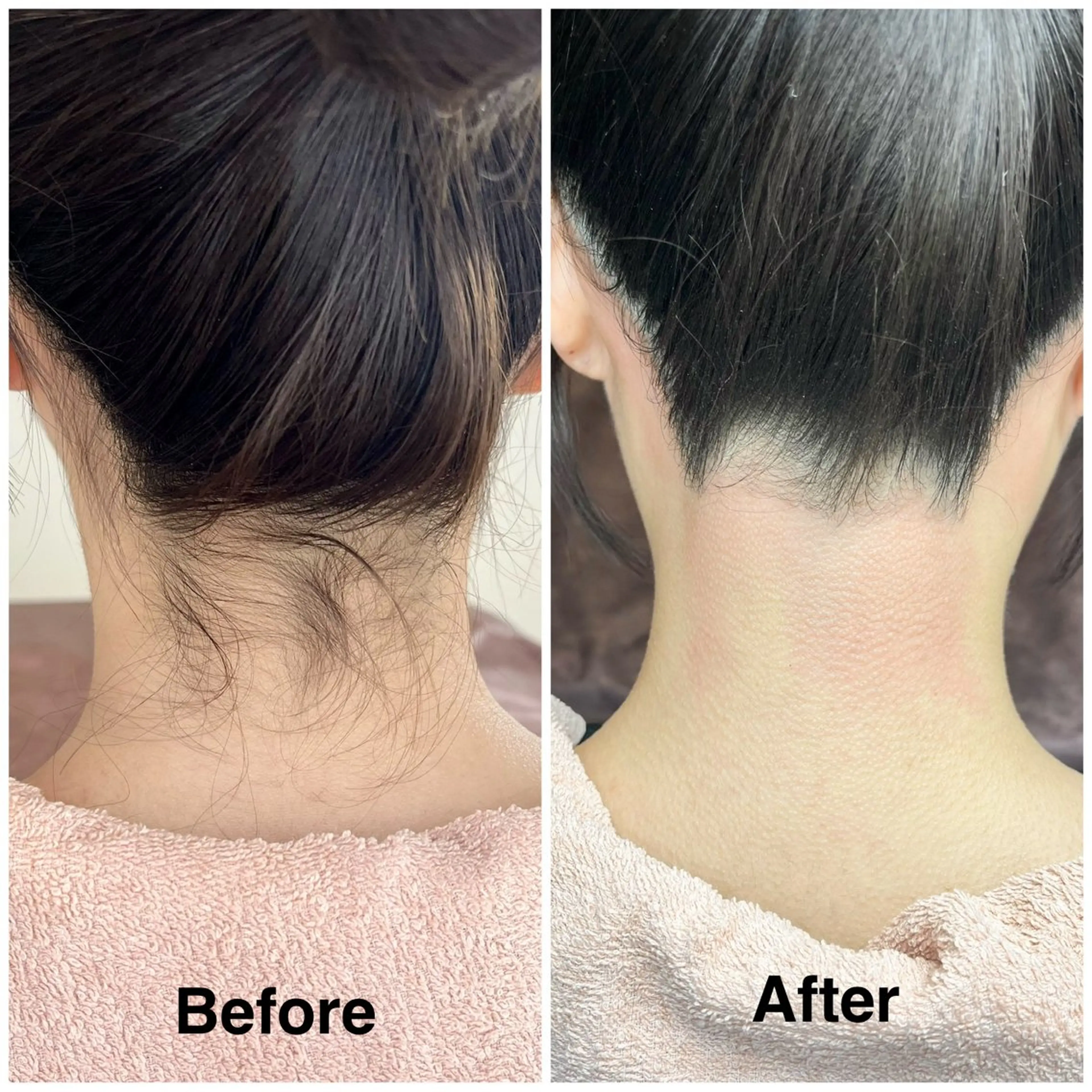 脱毛 高見 明子のエステ・リラクイメージ