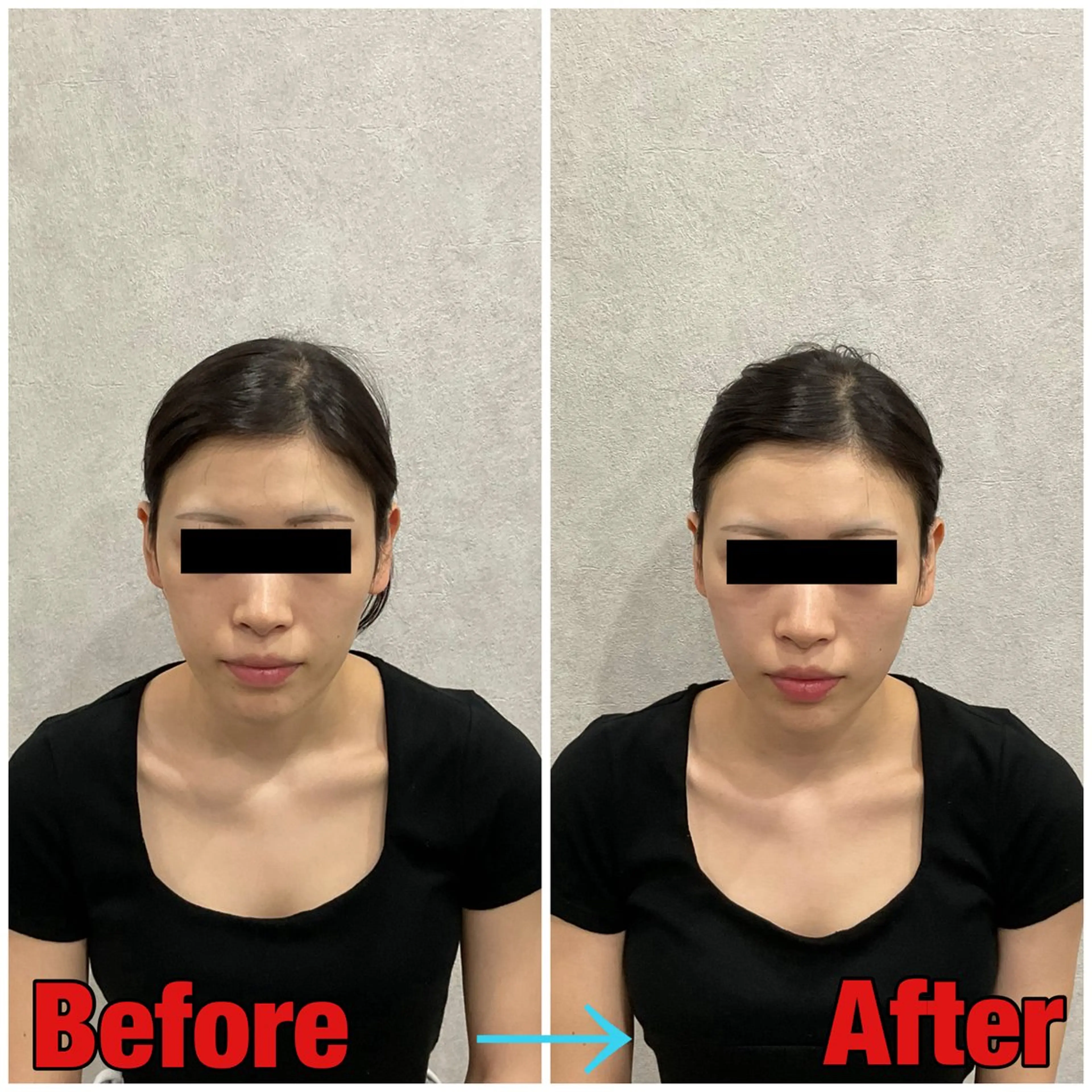 エステ リラク 小顔矯正・美容鍼 FLOW鍼灸整体院のエステ・リラクイメージ