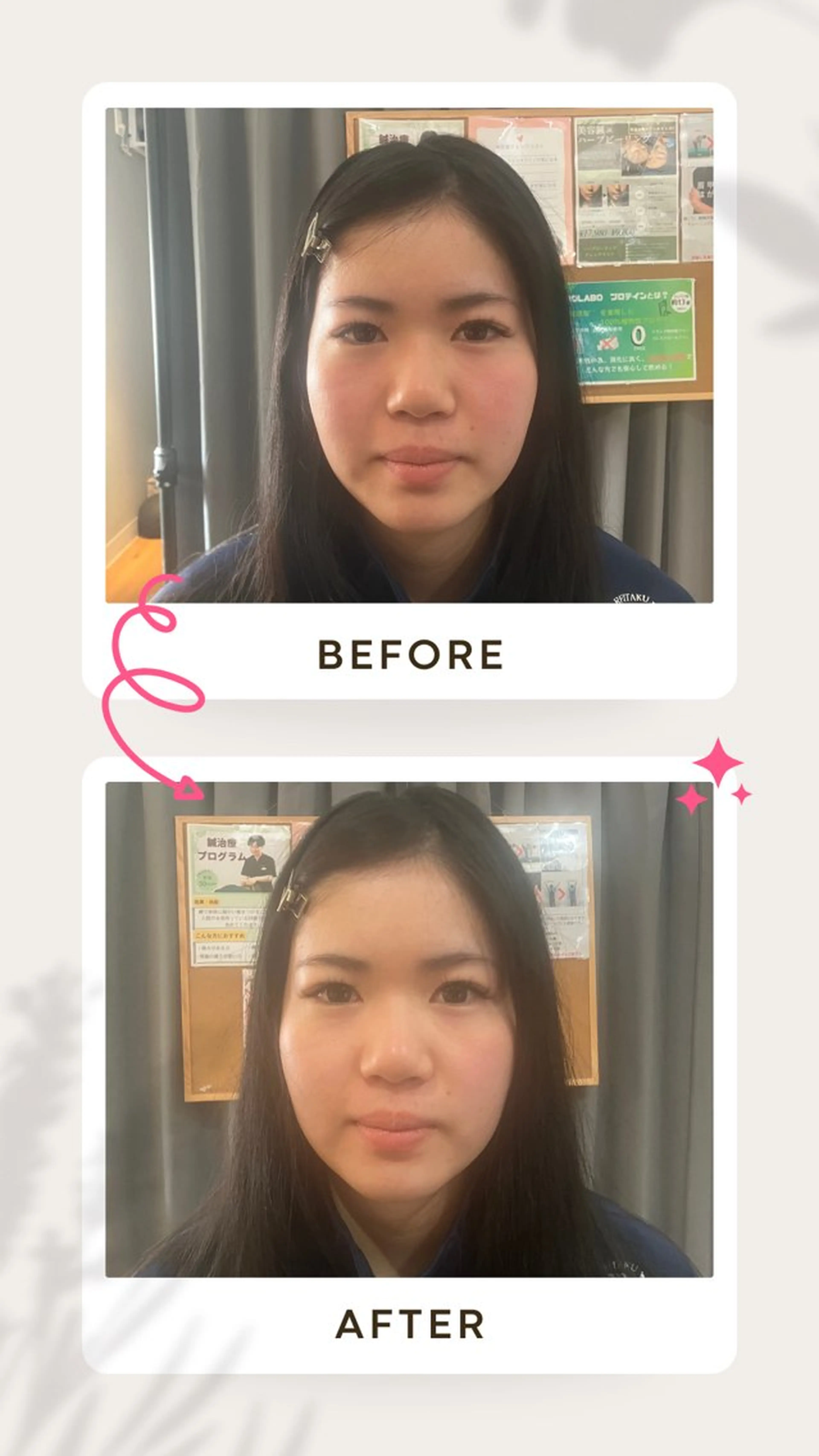 健康×美容鍼鍼灸院 あさば整体院三ノ輪店のエステ・リラクイメージ