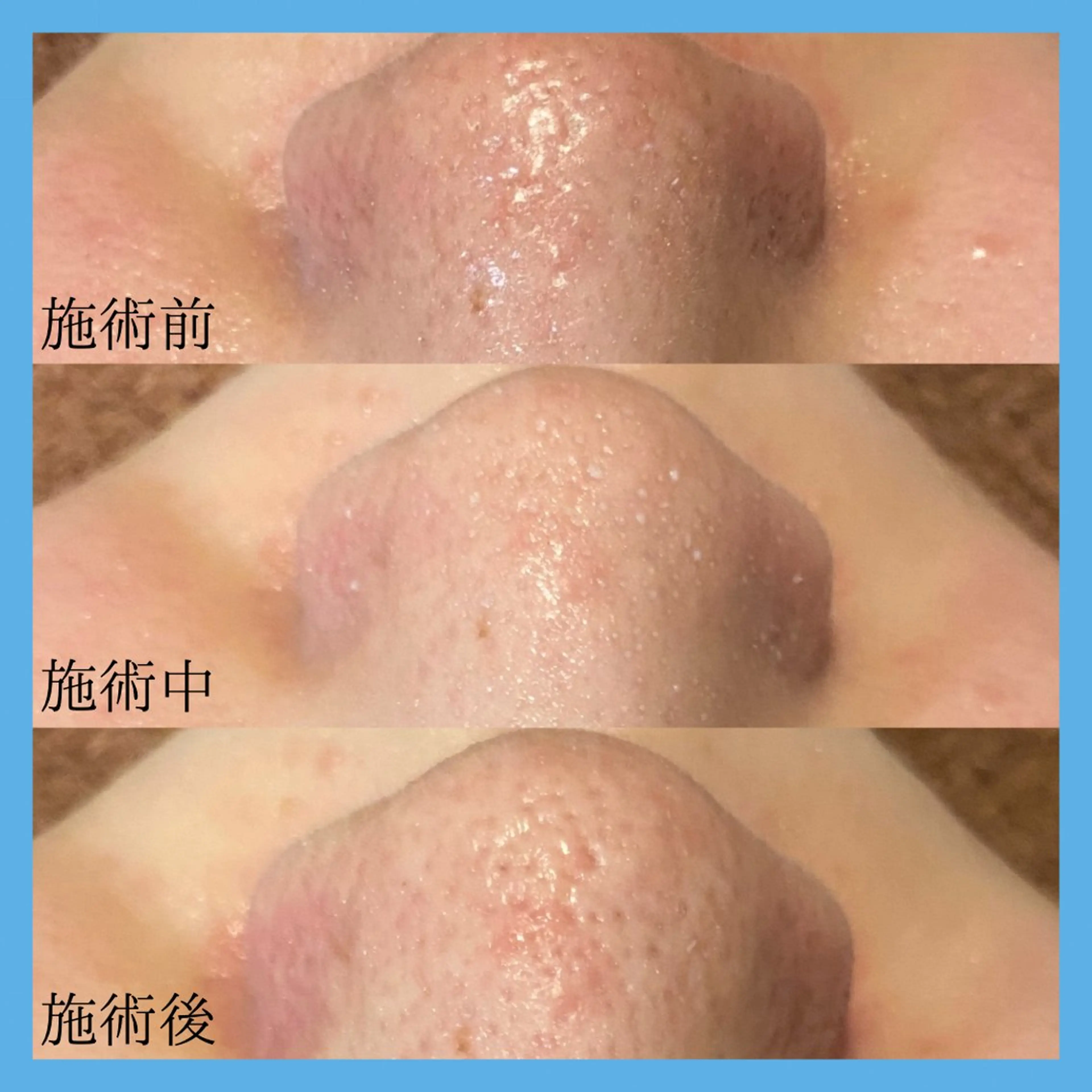 エステ 荒井 益美のエステ・リラクイメージ