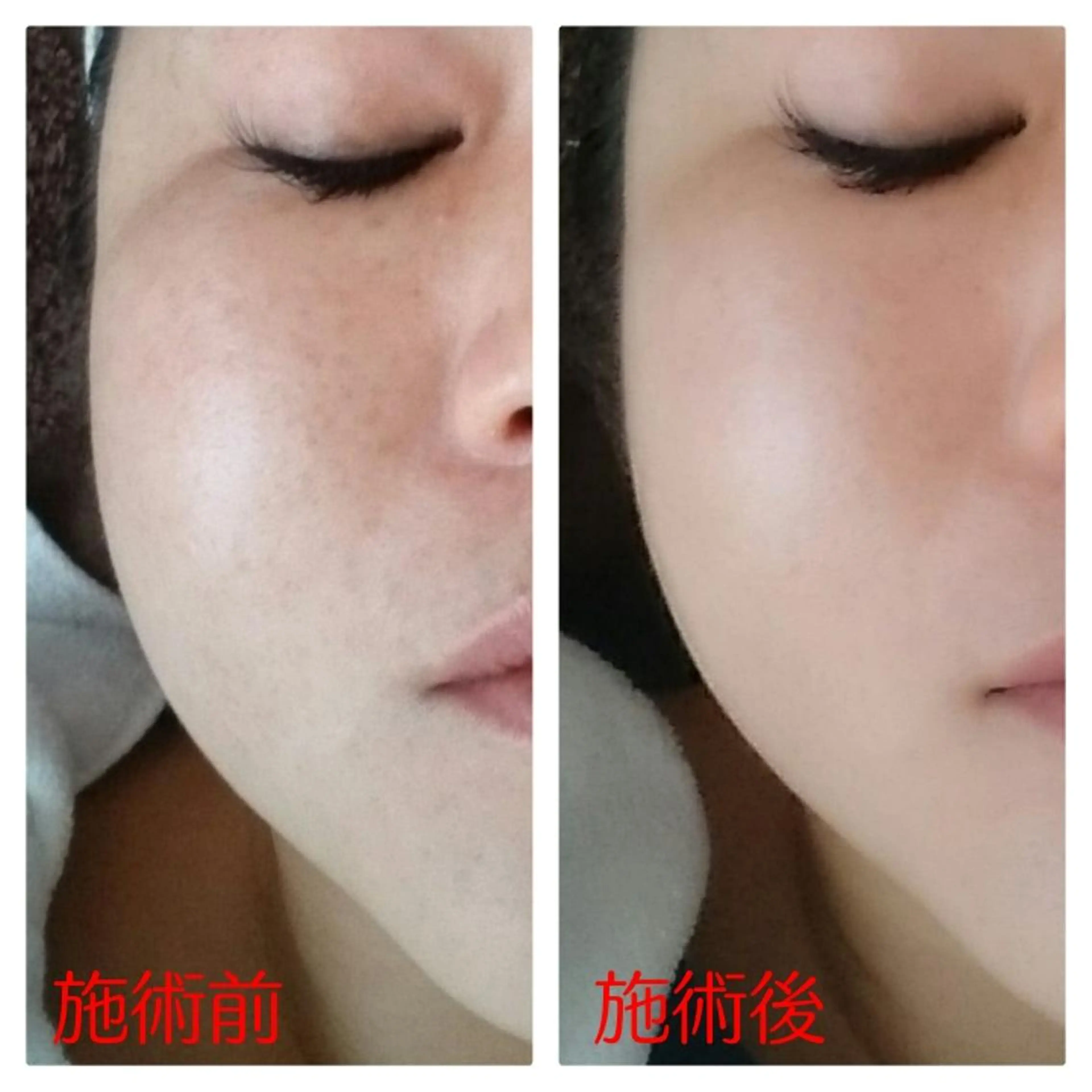 エステ リラク TotalBeauty axis所属・本気の痩身🕊渡邊 明子🕊のその他イメージ