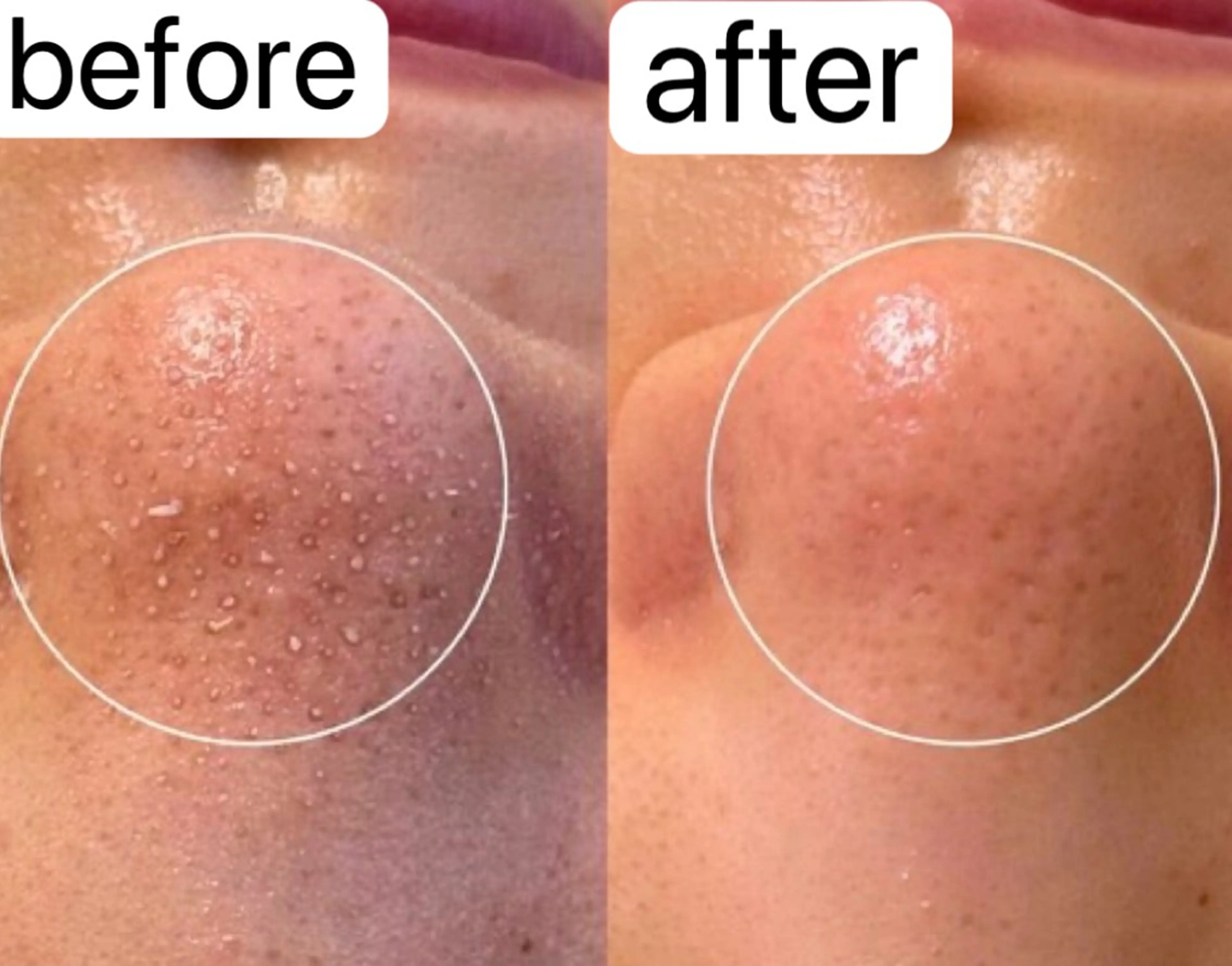 Belle原宿所属・佐藤 加奈のエステ・リラクイメージ