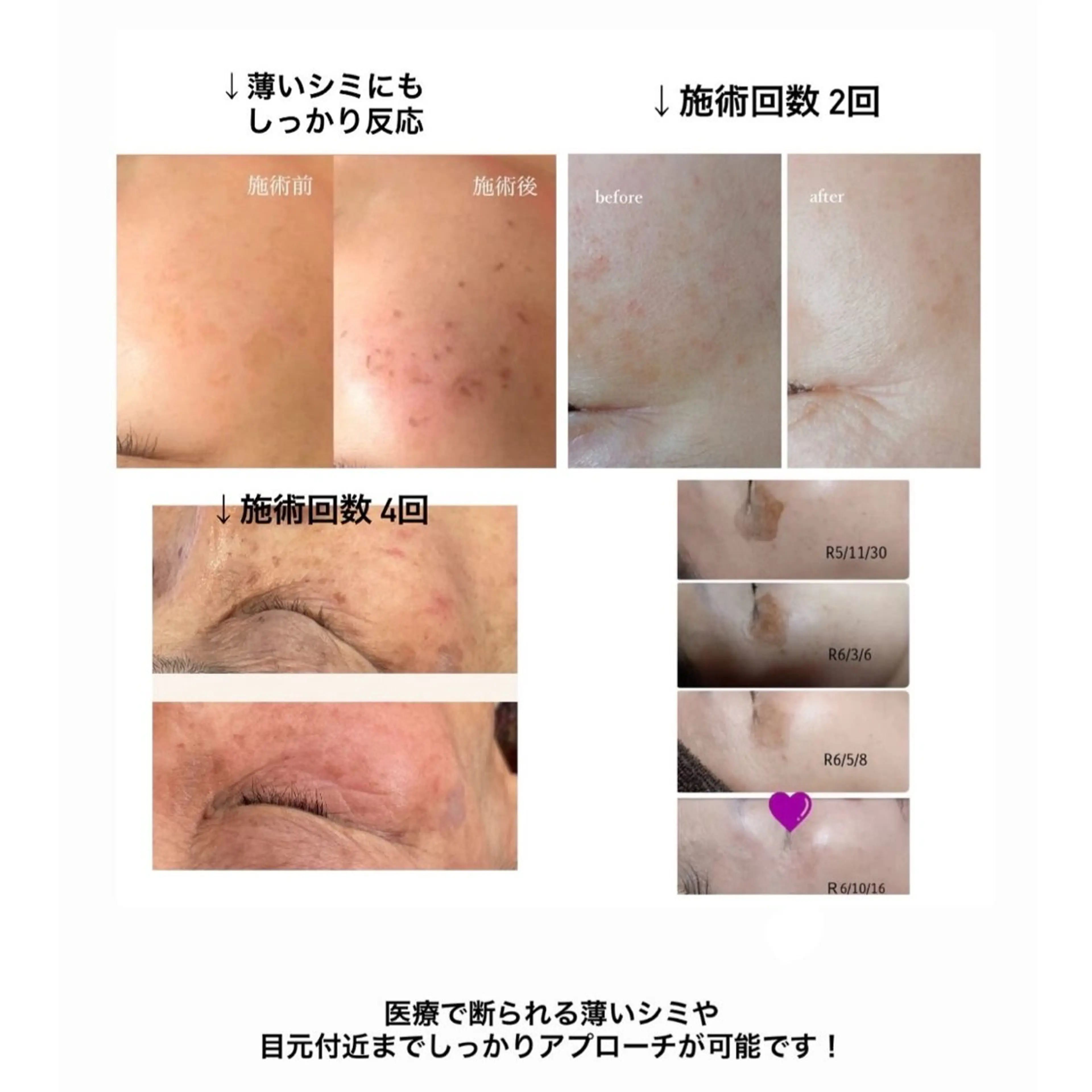 エステ 新石切ravis - ラヴィス -のその他イメージ