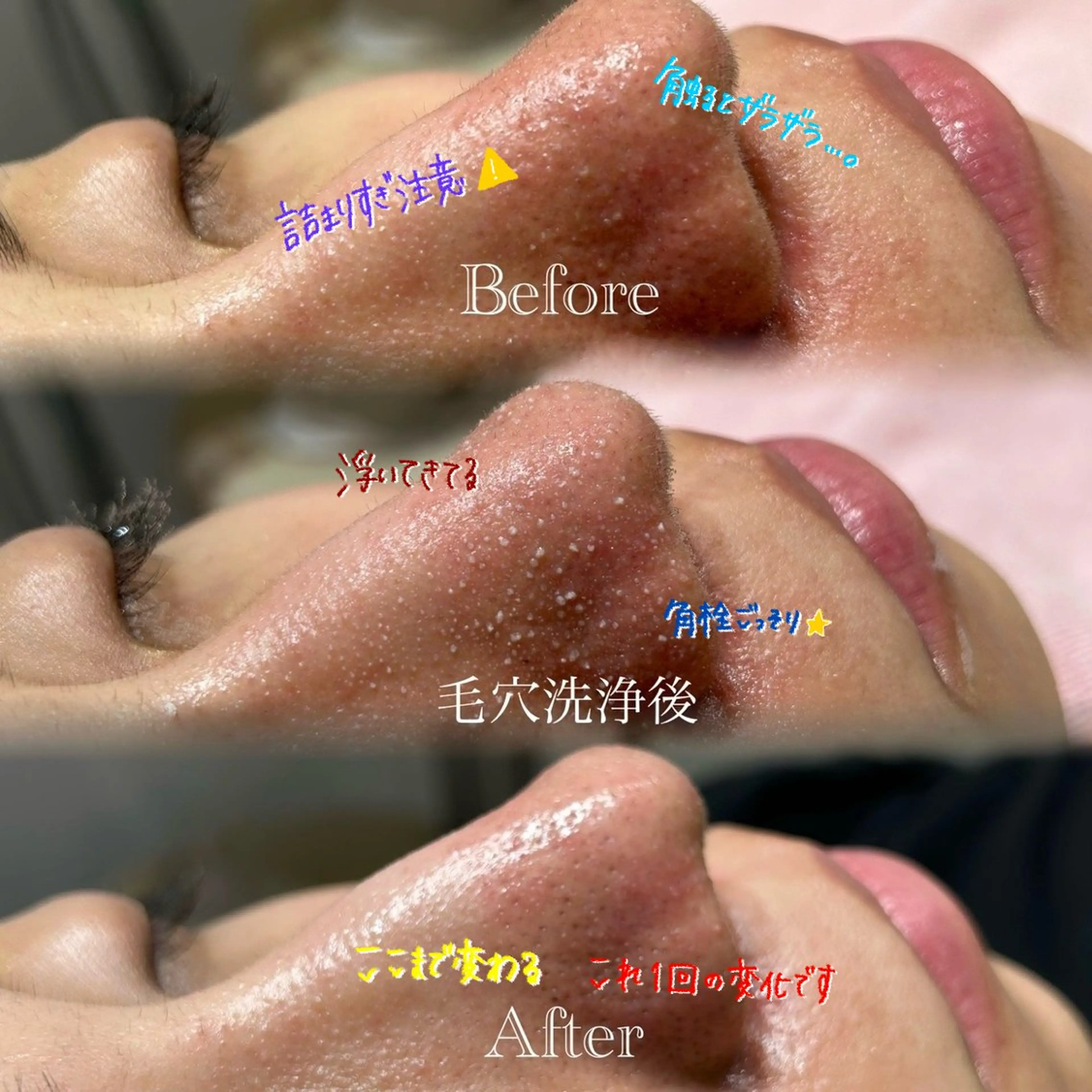 エステ リラク 🫧美しい素肌へ🫧 今成柚乃のその他イメージ