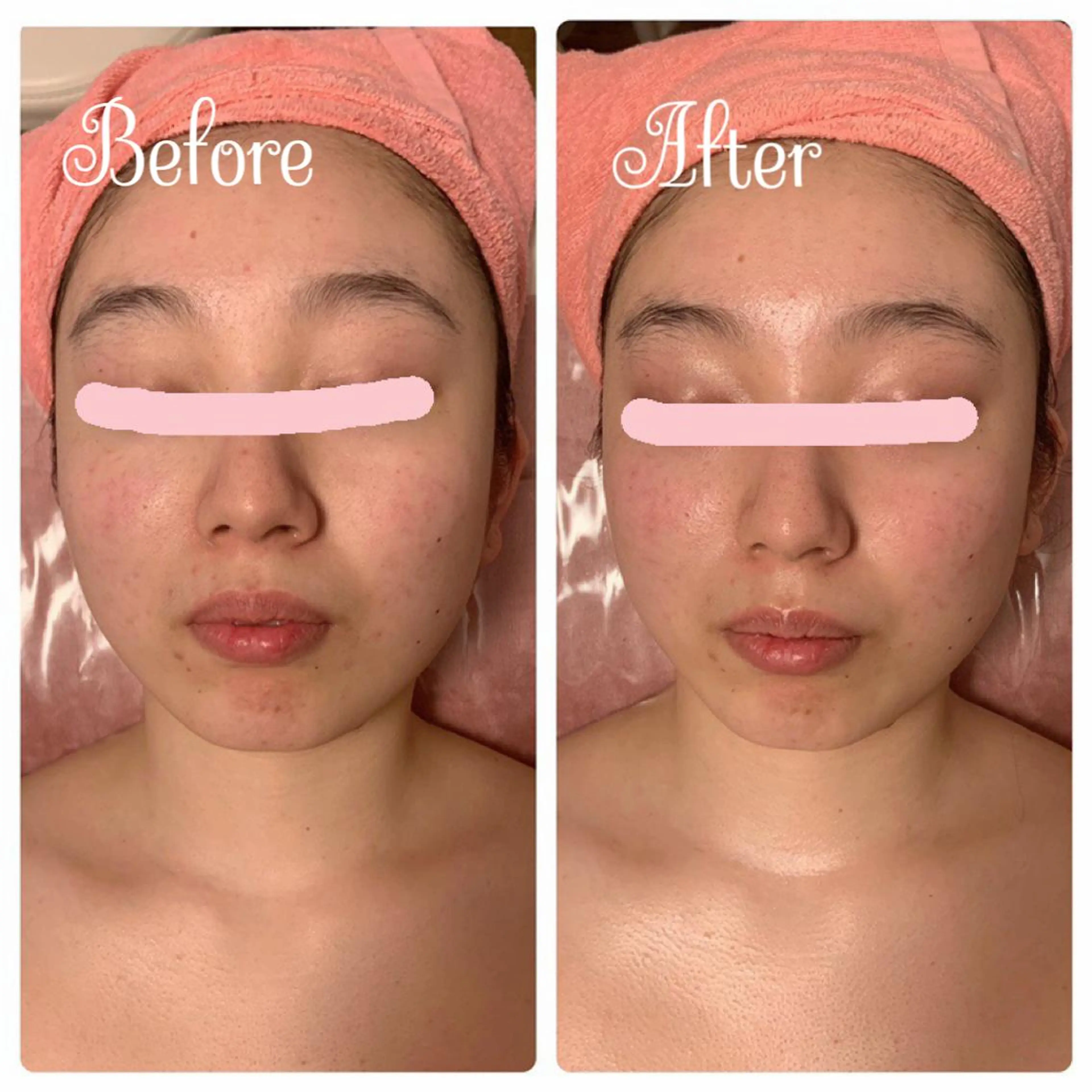 エステ リラク Linomalie エステ/たるみ/脱毛のエステ・リラクイメージ