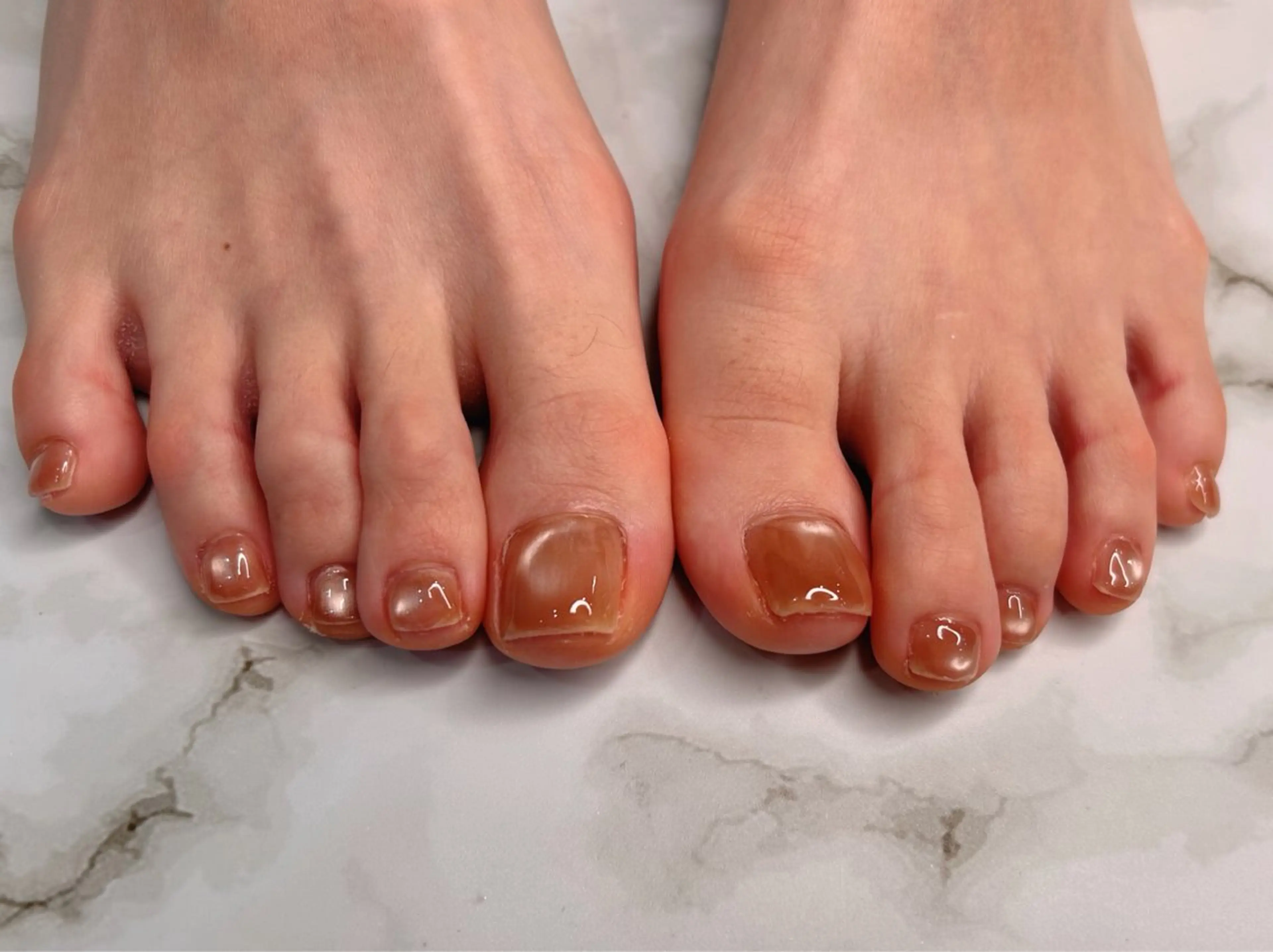 ネイル フットネイル edit MINAMIのネイルデザイン