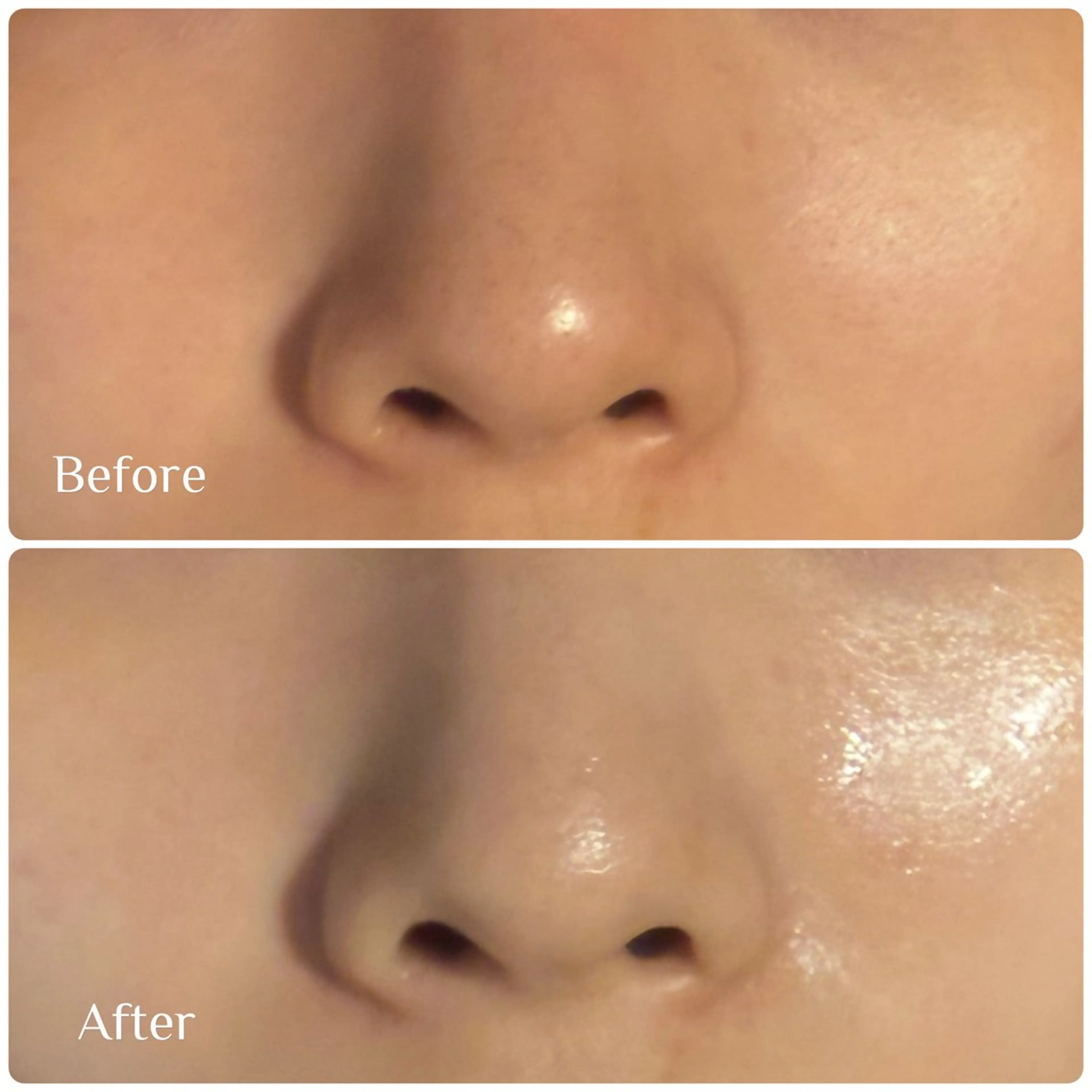 脱毛 フェイシャル soin～ソワン～のエステ・リラクイメージ