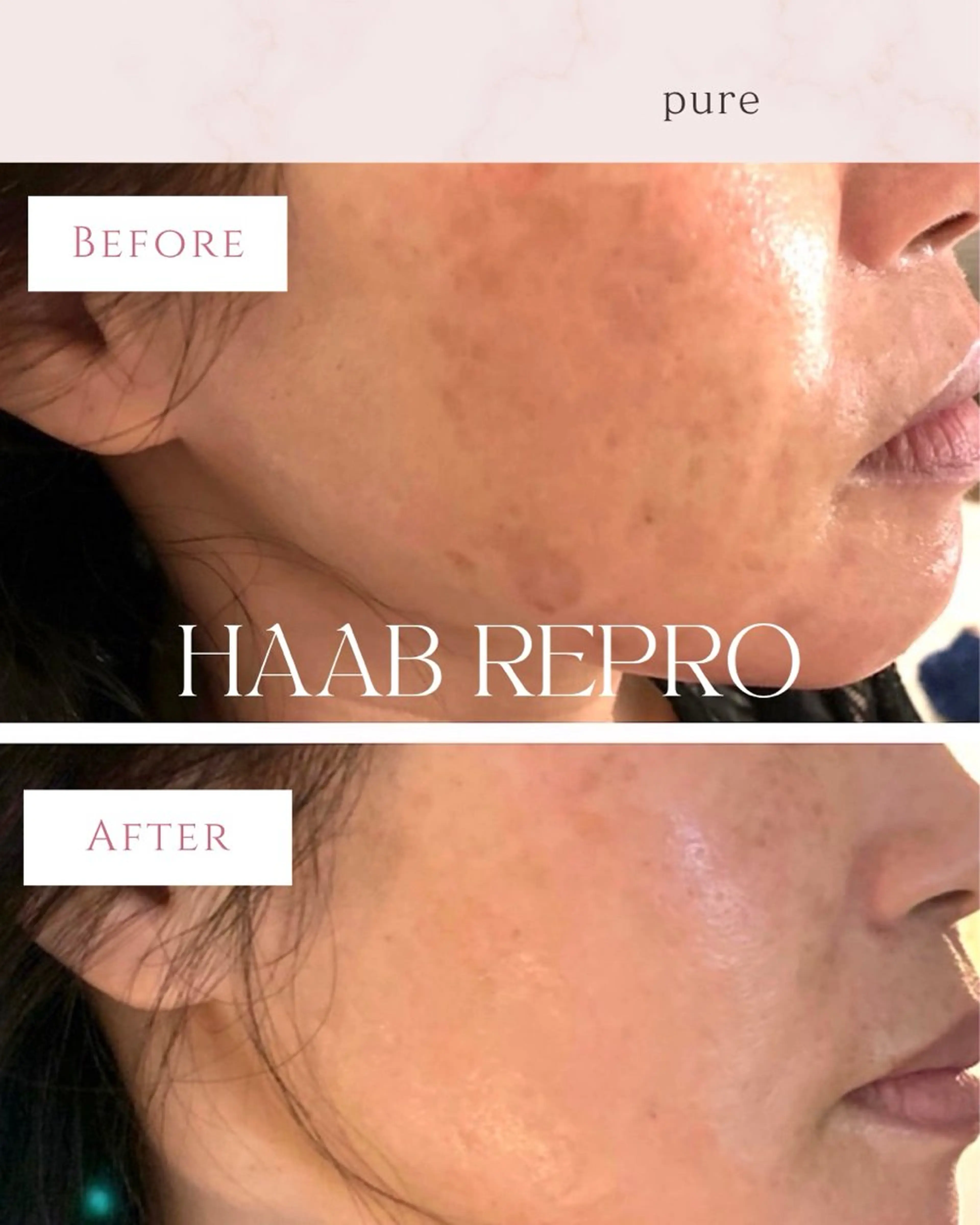 pure所属・肌質改善ピーリング pure 一番町のエステ・リラクイメージ