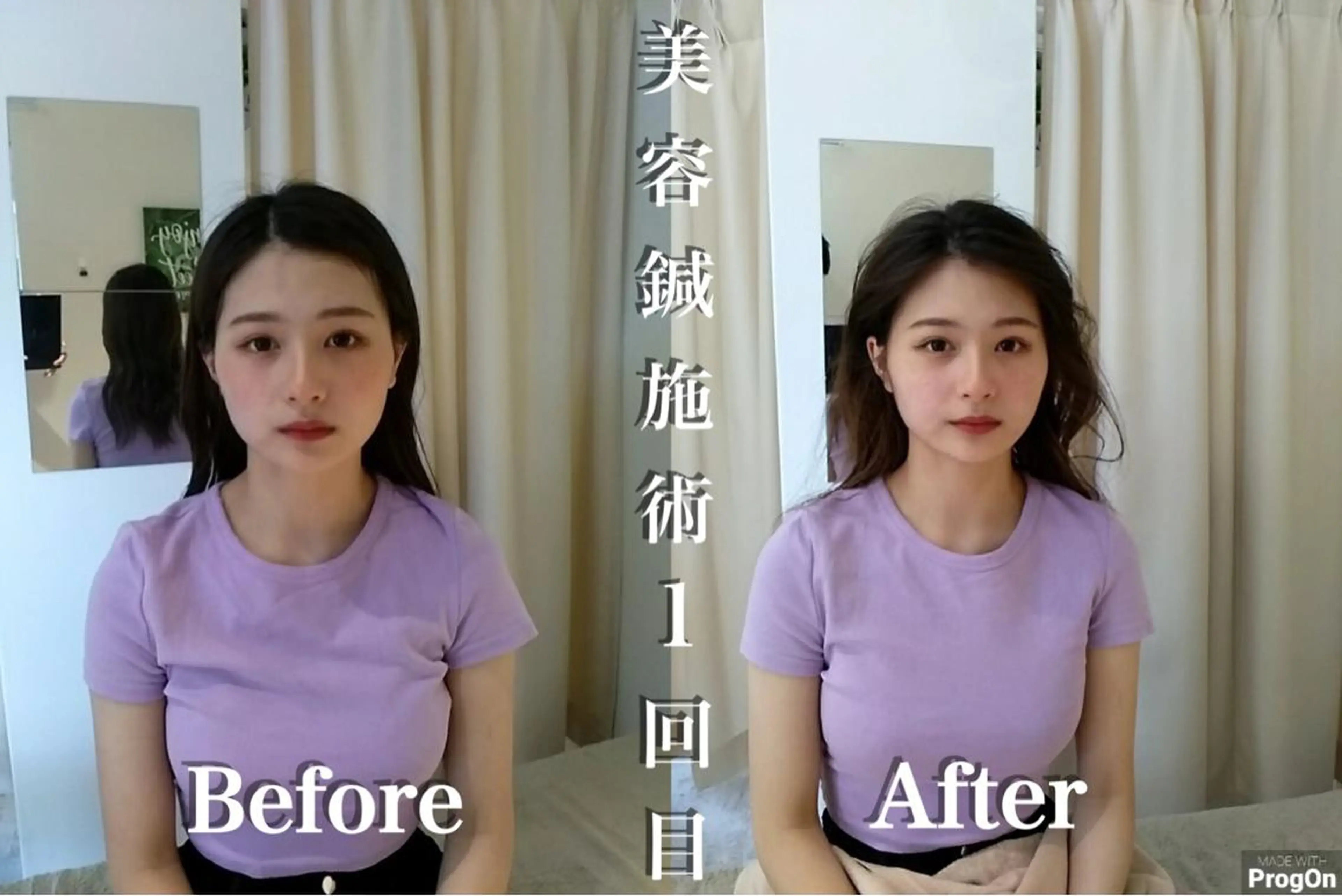 鍼灸 Refineのその他イメージ