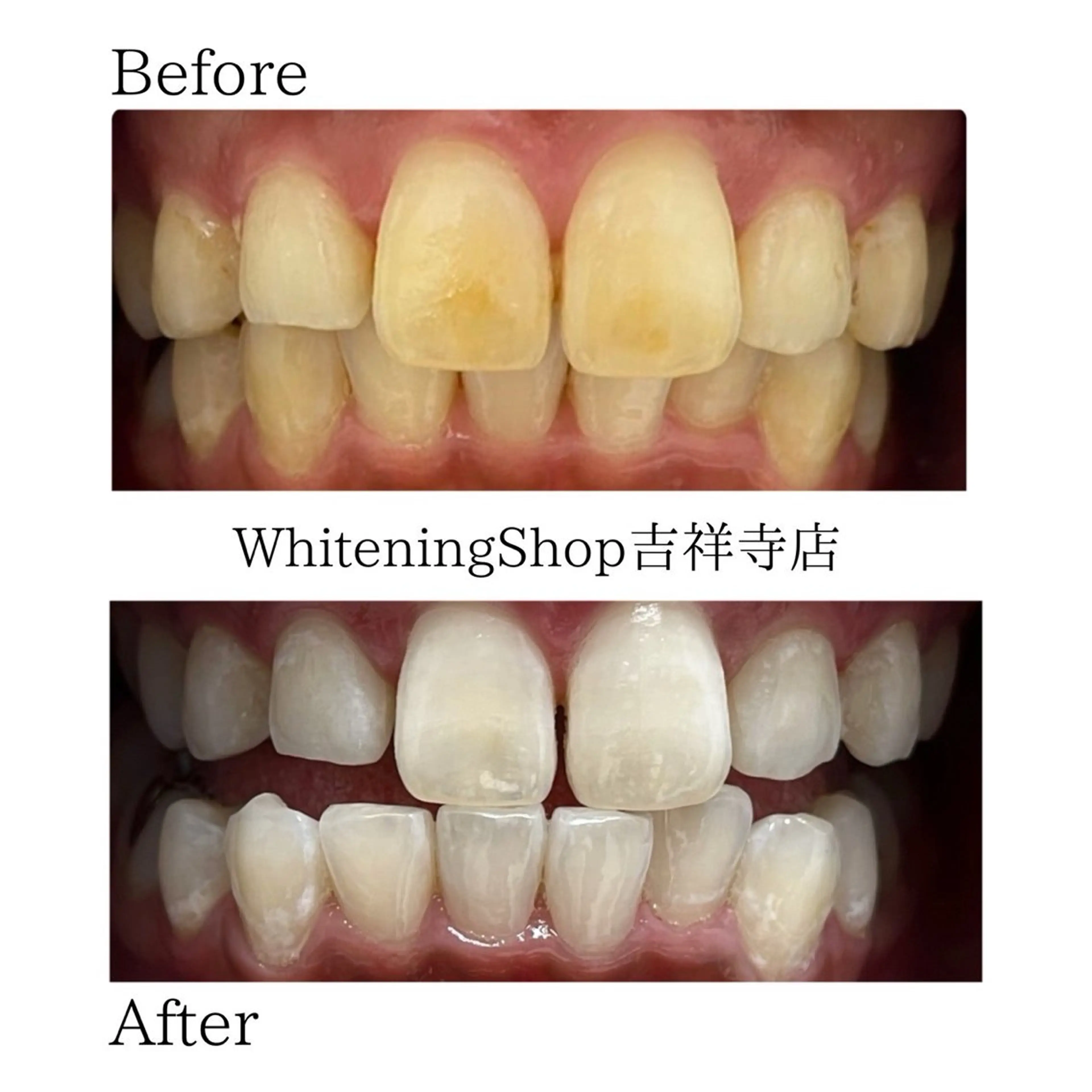 エステ リラク ホワイトニング ショップ吉祥寺店のエステ・リラクイメージ