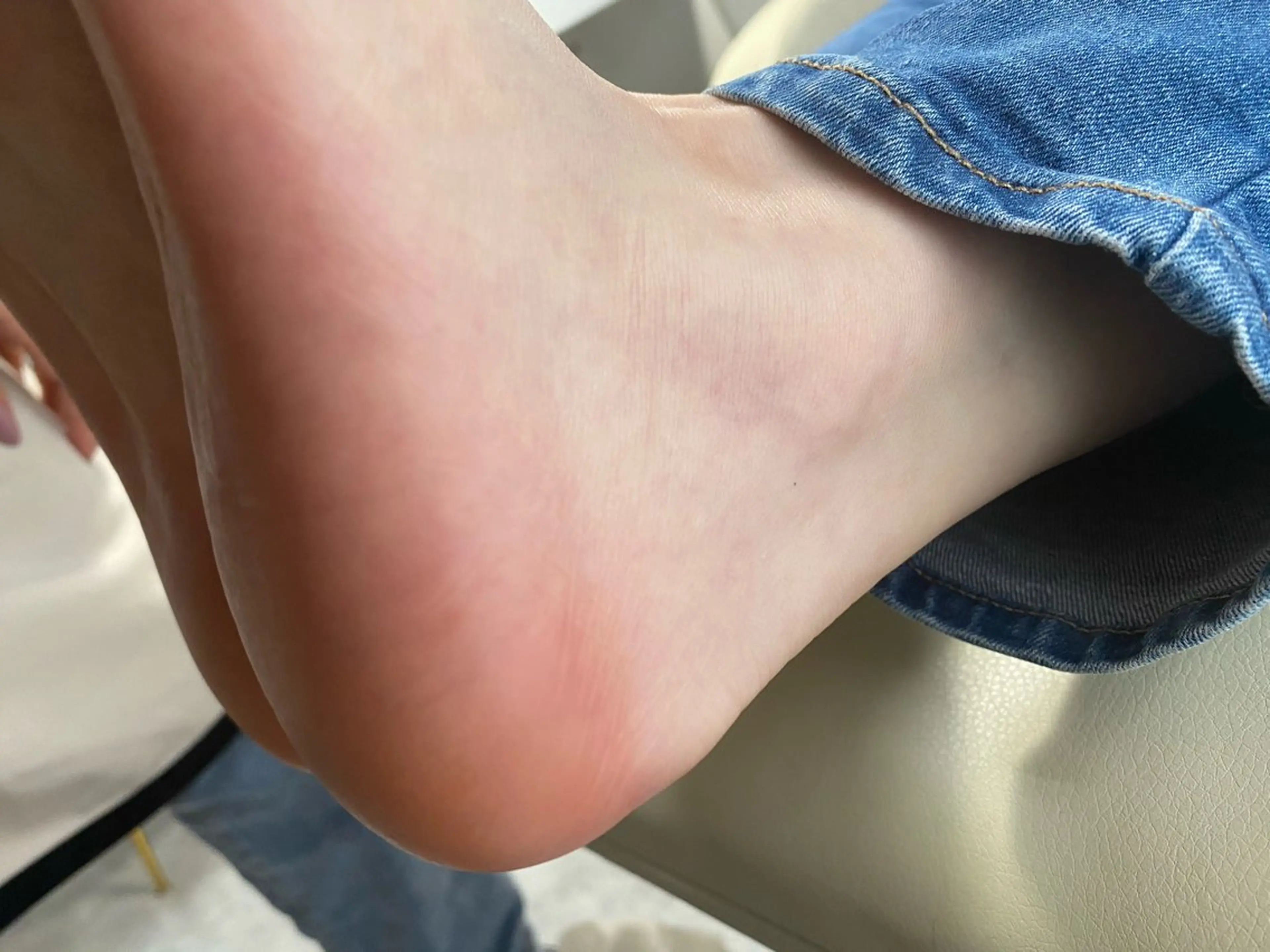 【マッサージ、トリートメント付き】角質除去の写真