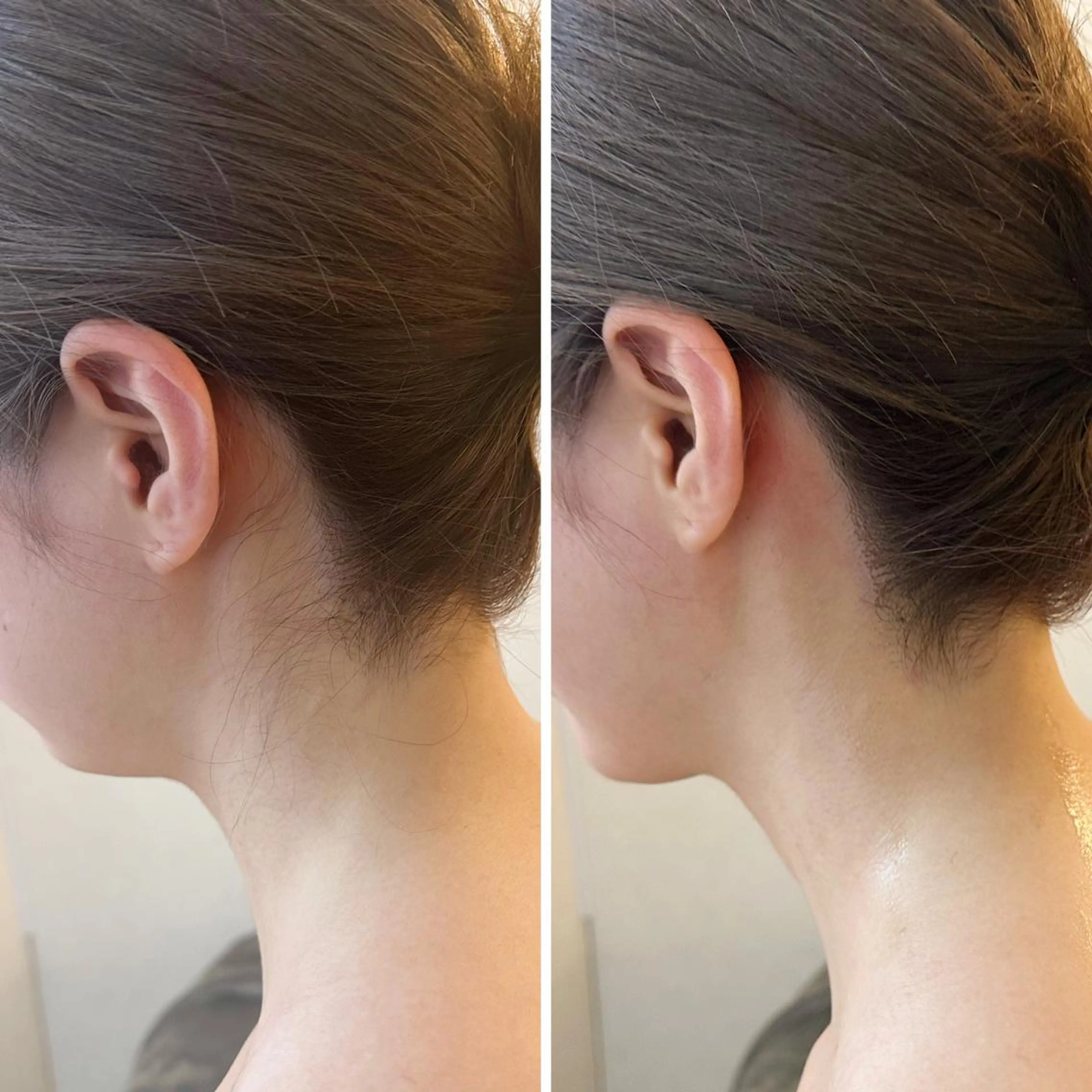 うなじ脱毛/美肌脱毛 LABELのエステ・リラクイメージ