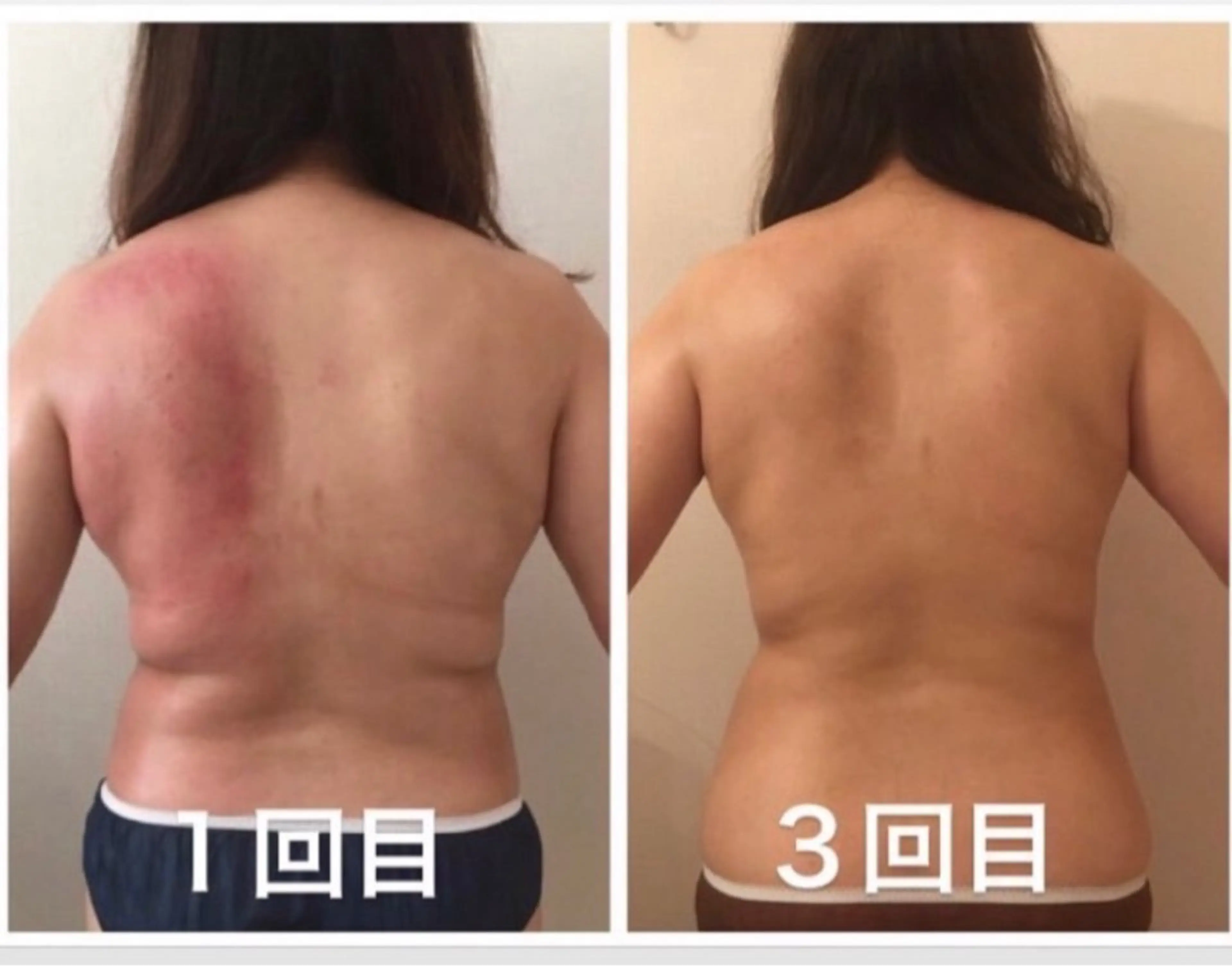 トータルビューティ サロンstageのエステ・リラクイメージ