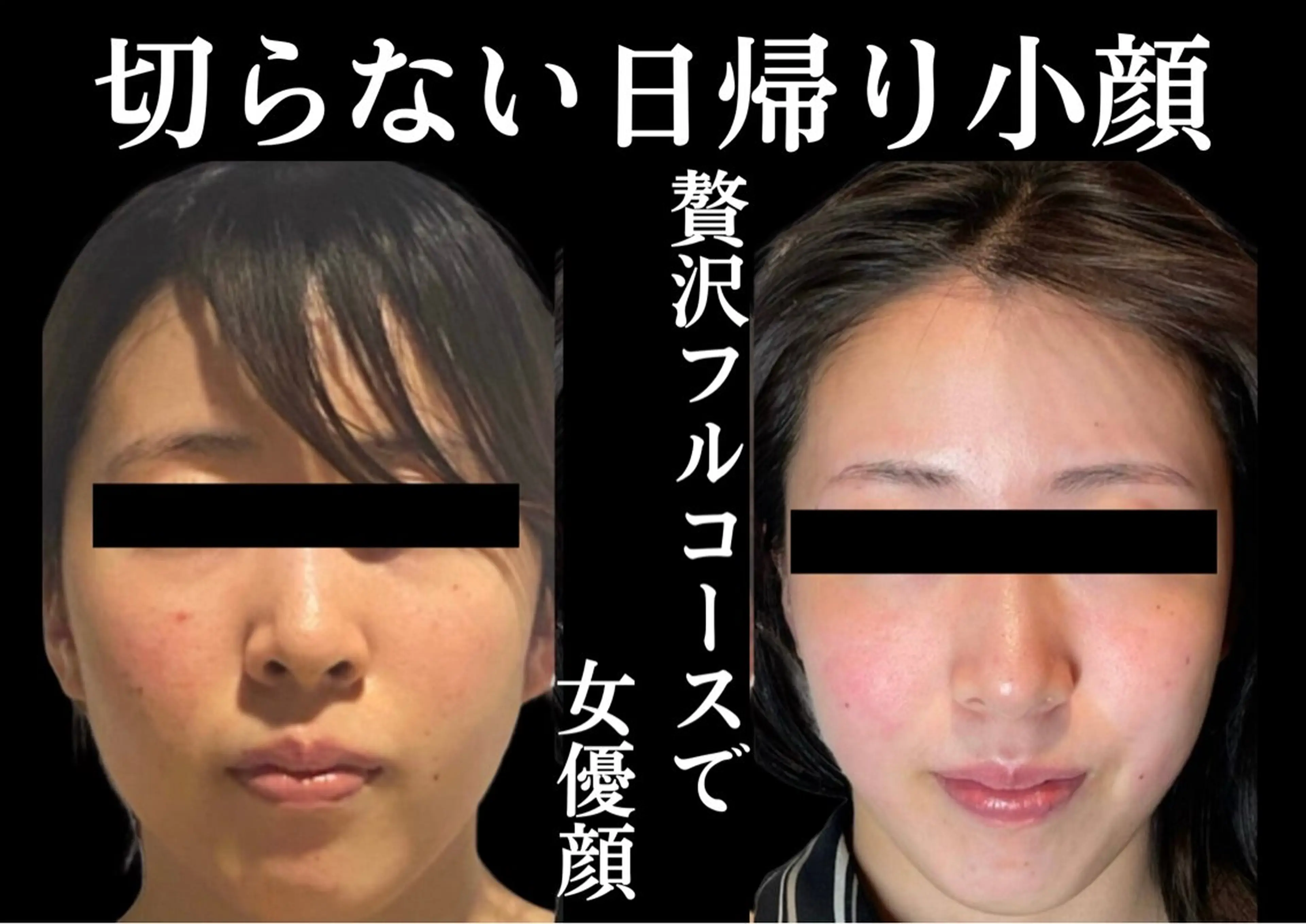 小顔・たるみ専門看護師クリニカルサロンTROIS所属・クリニカルサロン トロワのエステ・リラクイメージ