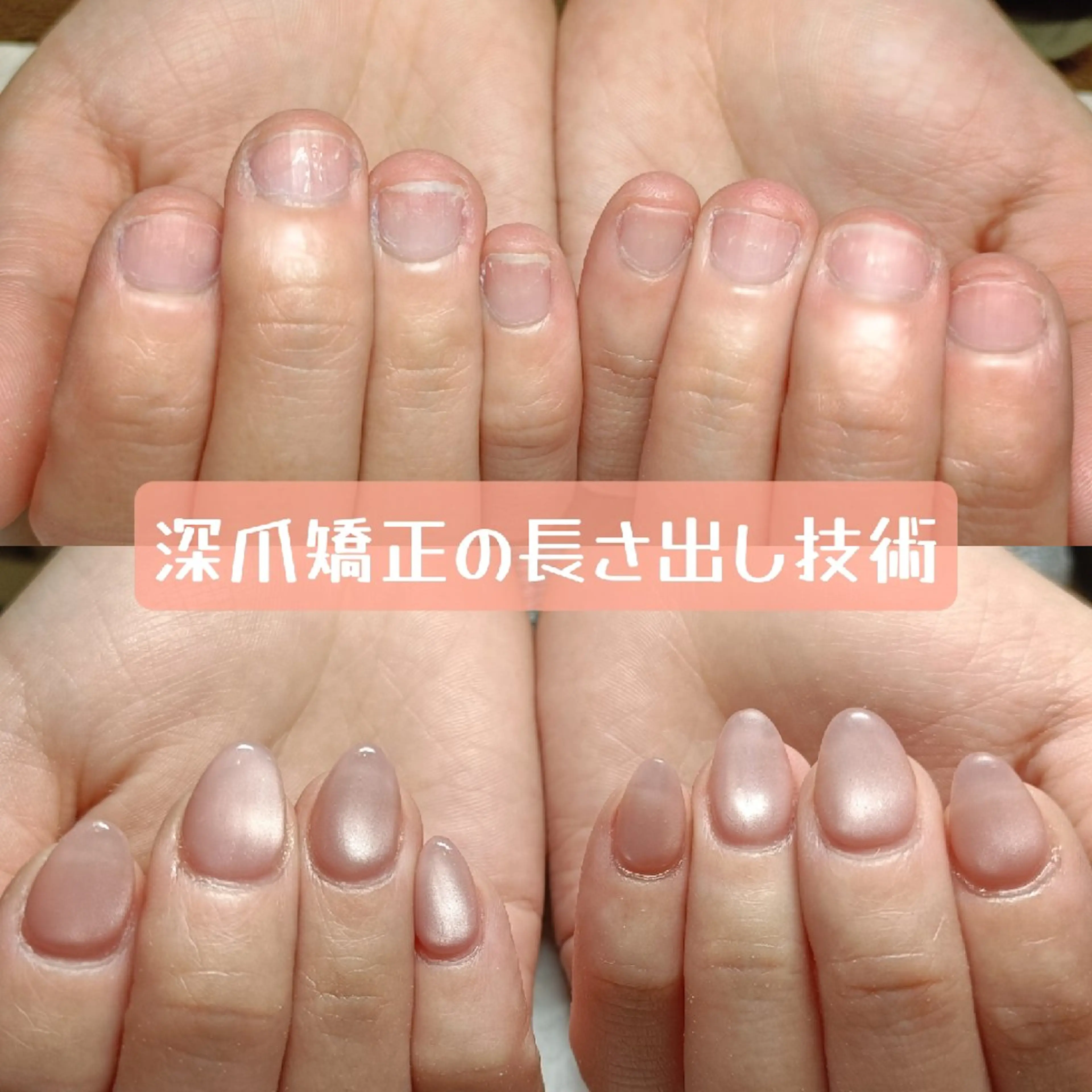ネイル マグネットネイル スカルプネイル ハンドネイル ハンドケア 深爪矯正/爪育成ケア manie nailのネイルデザイン