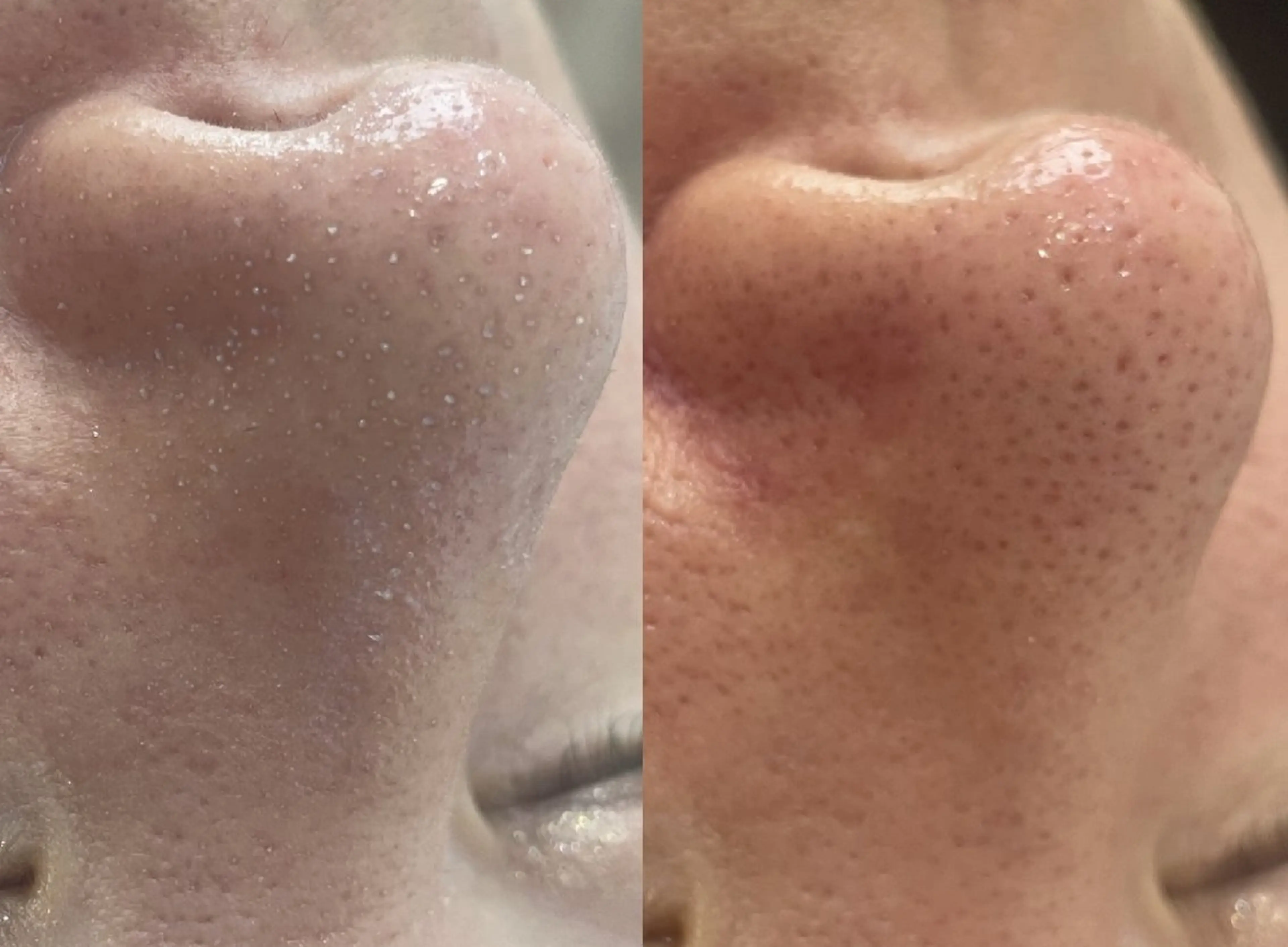 エステ sii MIUのエステ・リラクイメージ