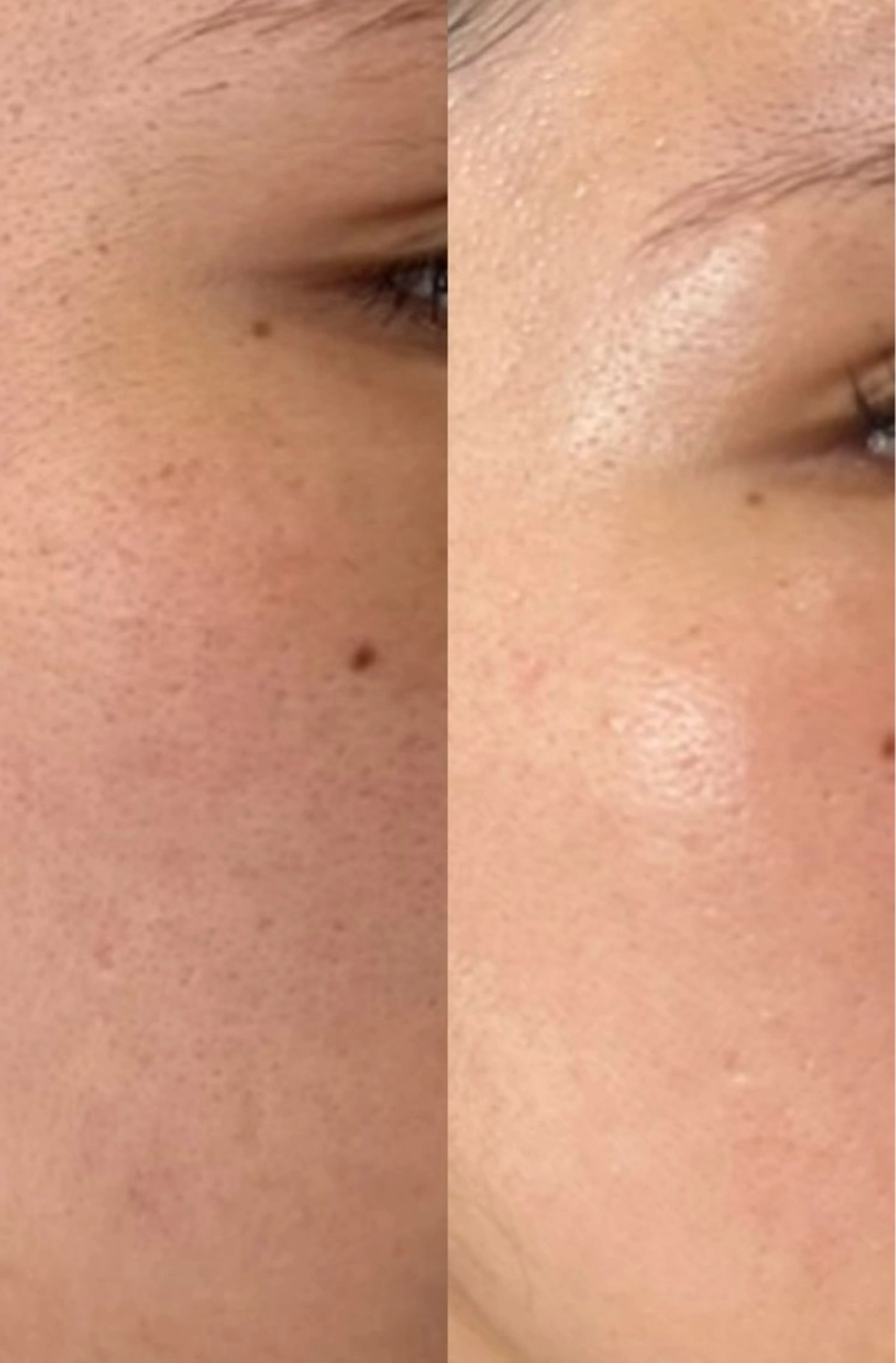 スキンケア１ヶ月モニターの写真