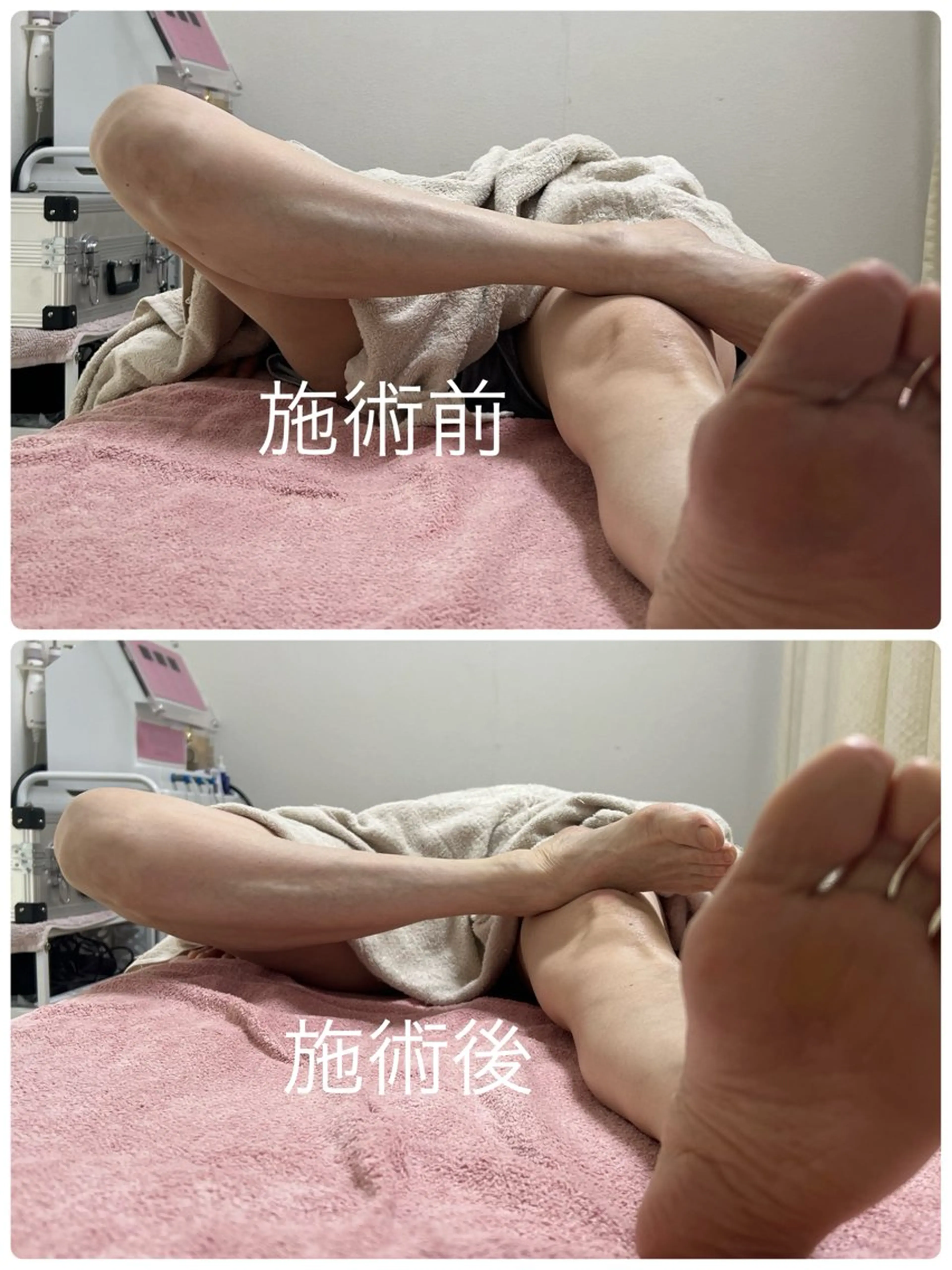 小顔と腸の専門店 ラクーラビューティのエステ・リラクイメージ