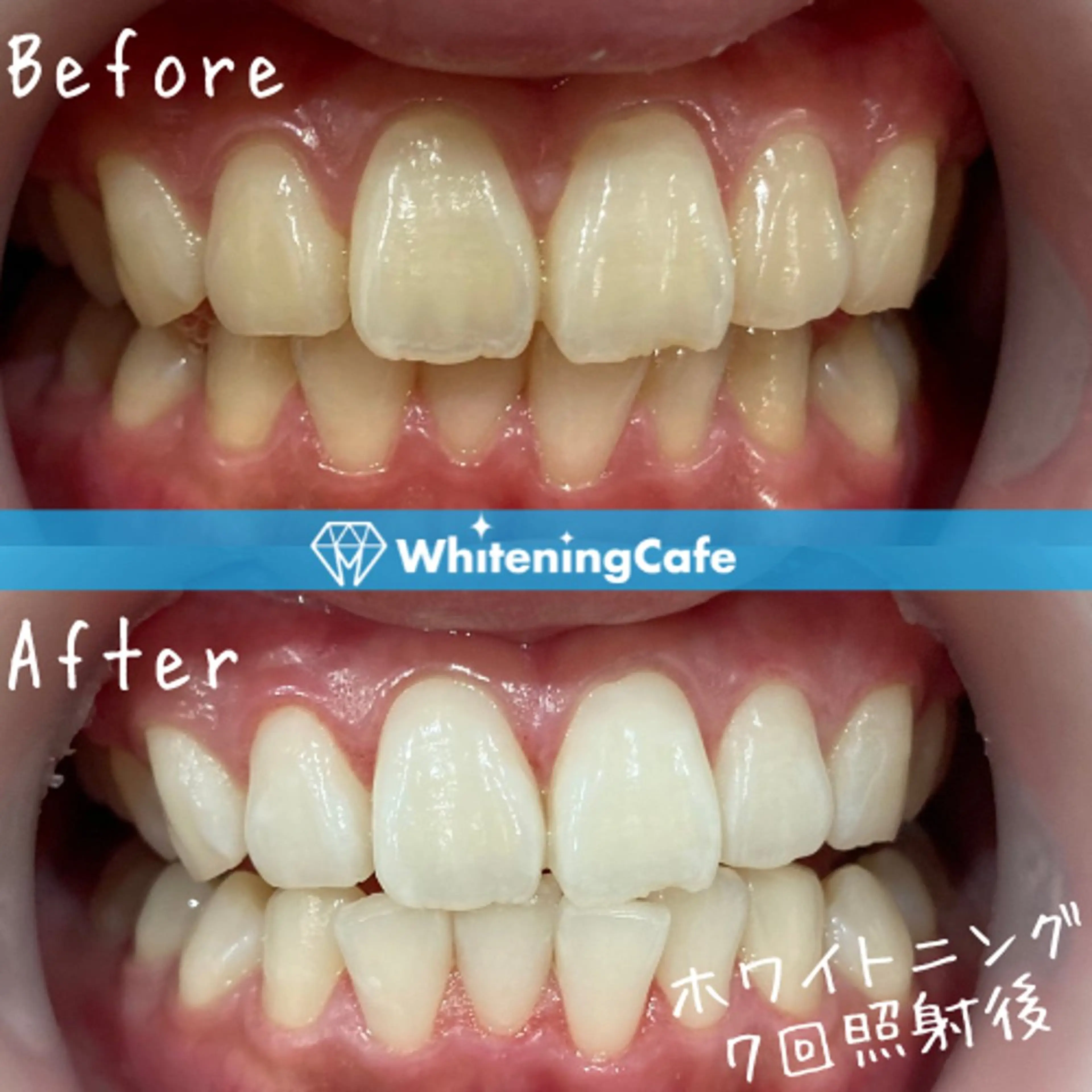 ホワイトニングカフェ 神戸元町店のエステ・リラクイメージ