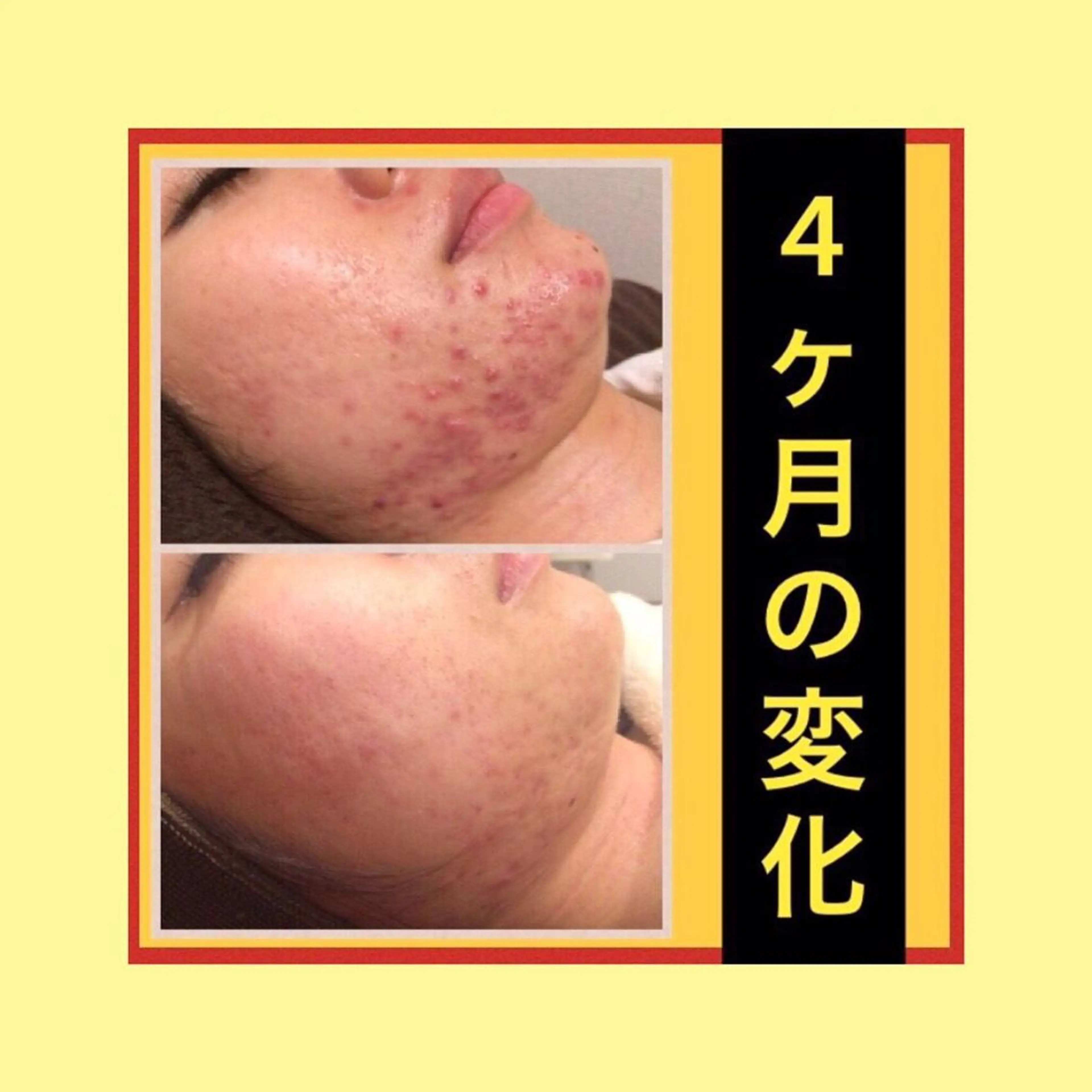 ミディアム パーマ ヘアアレンジ キッズ ネイル マツエク・マツパ ニキビ・肌質改善専門 ♡人生が変わるサロンのエステ・リラクイメージ