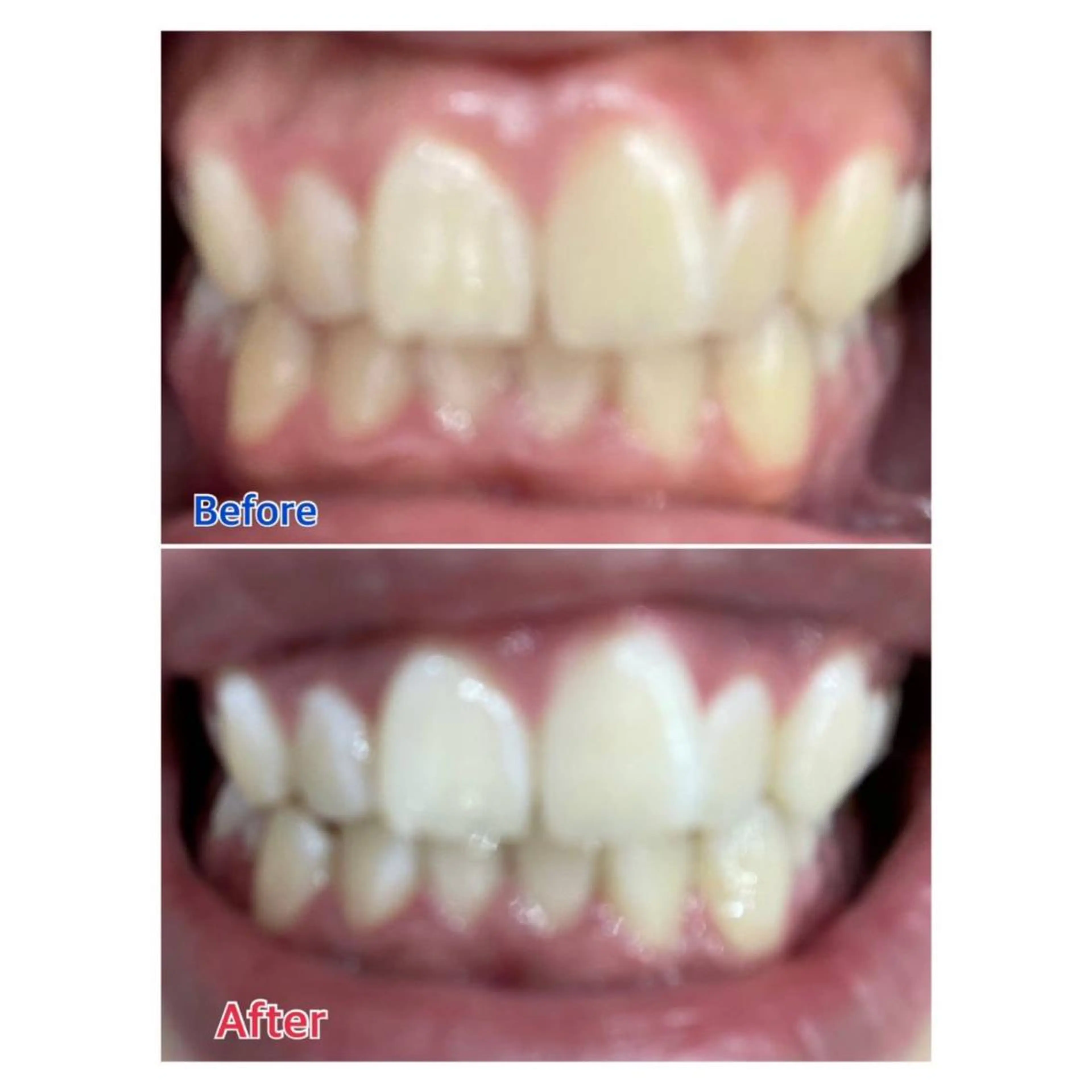 MBEAUTYSALON 千葉店・京成大久保所属・Melty 輝のその他イメージ