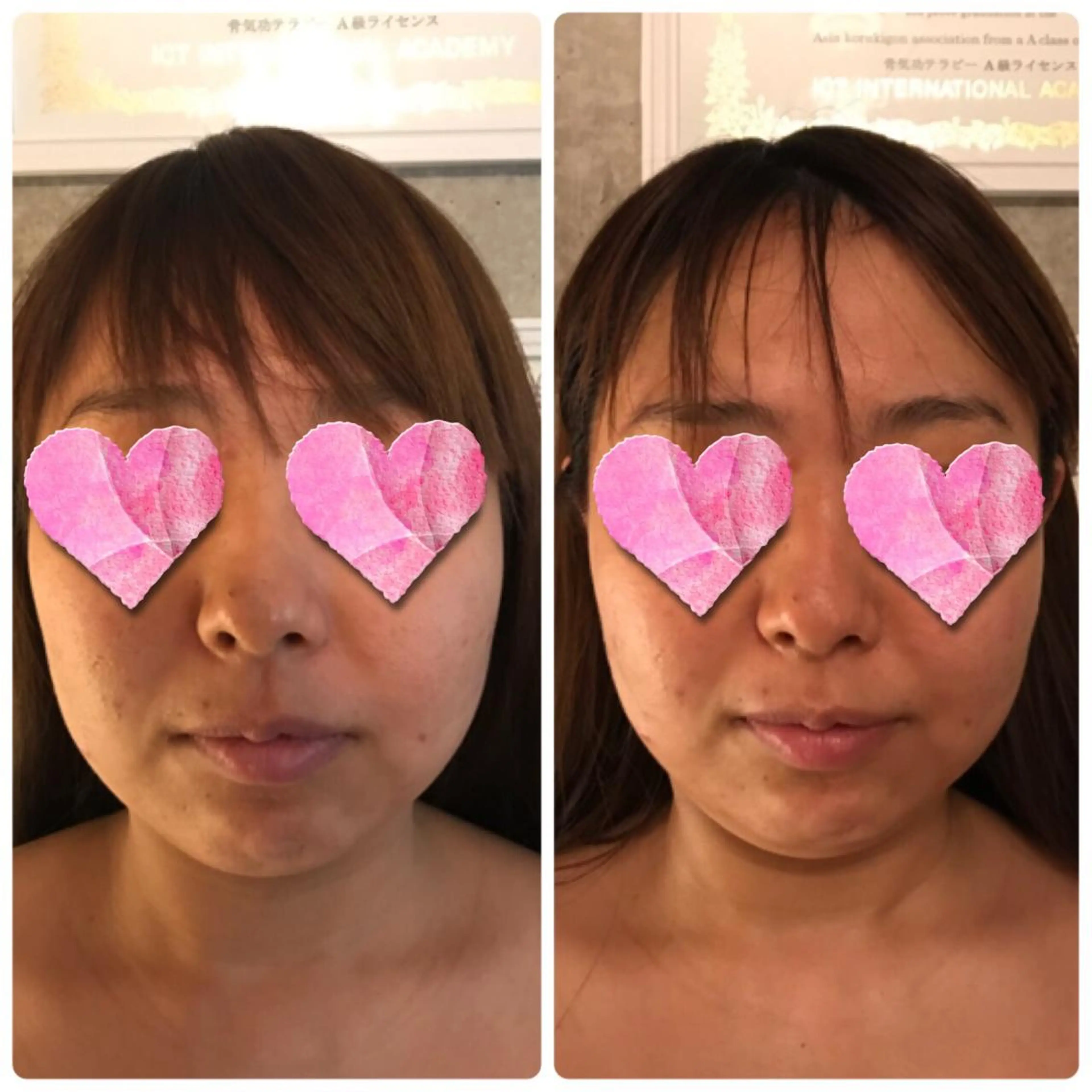 マツエク・マツパ JEIL michikoのエステ・リラクイメージ