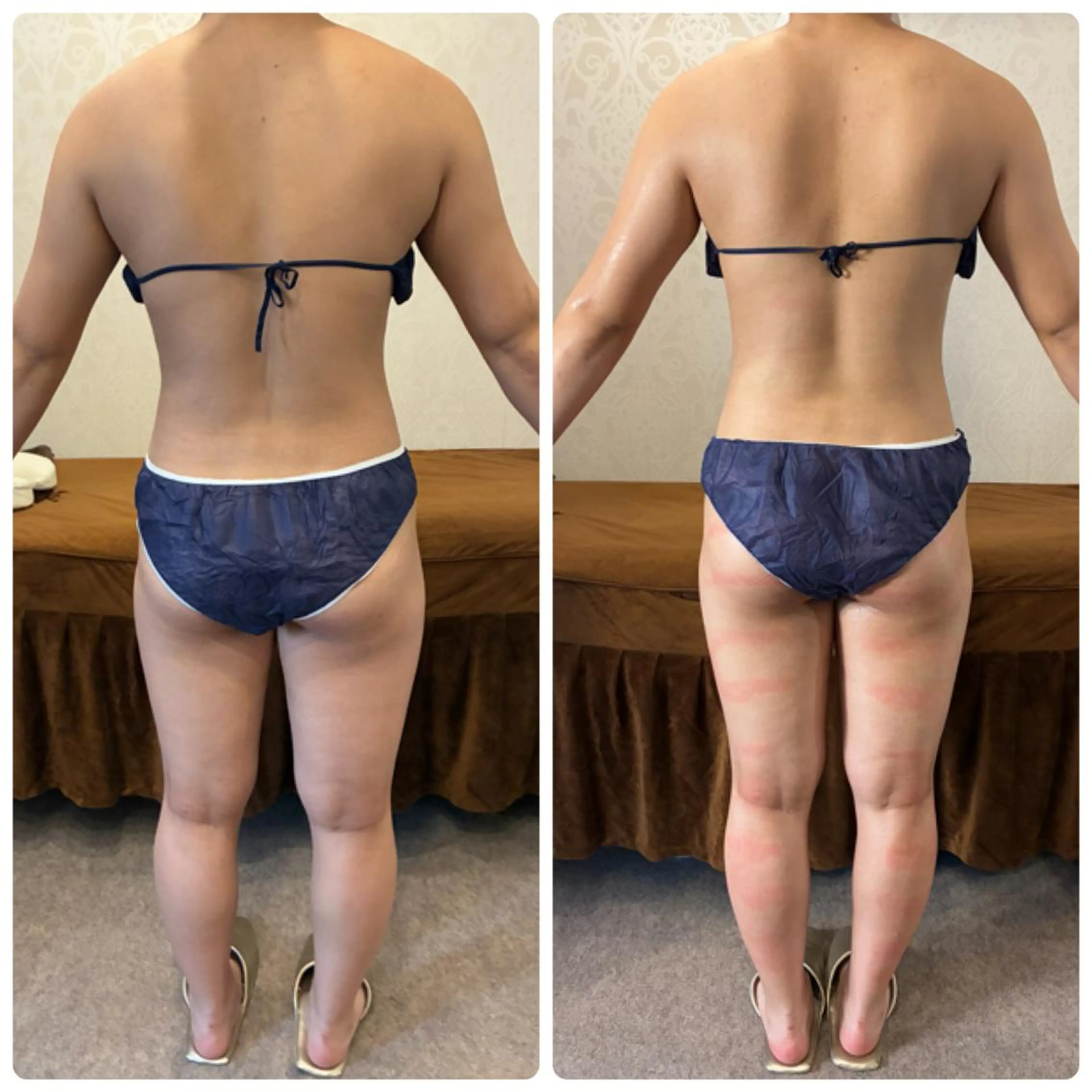 FLEUR 2号店のエステ・リラクイメージ