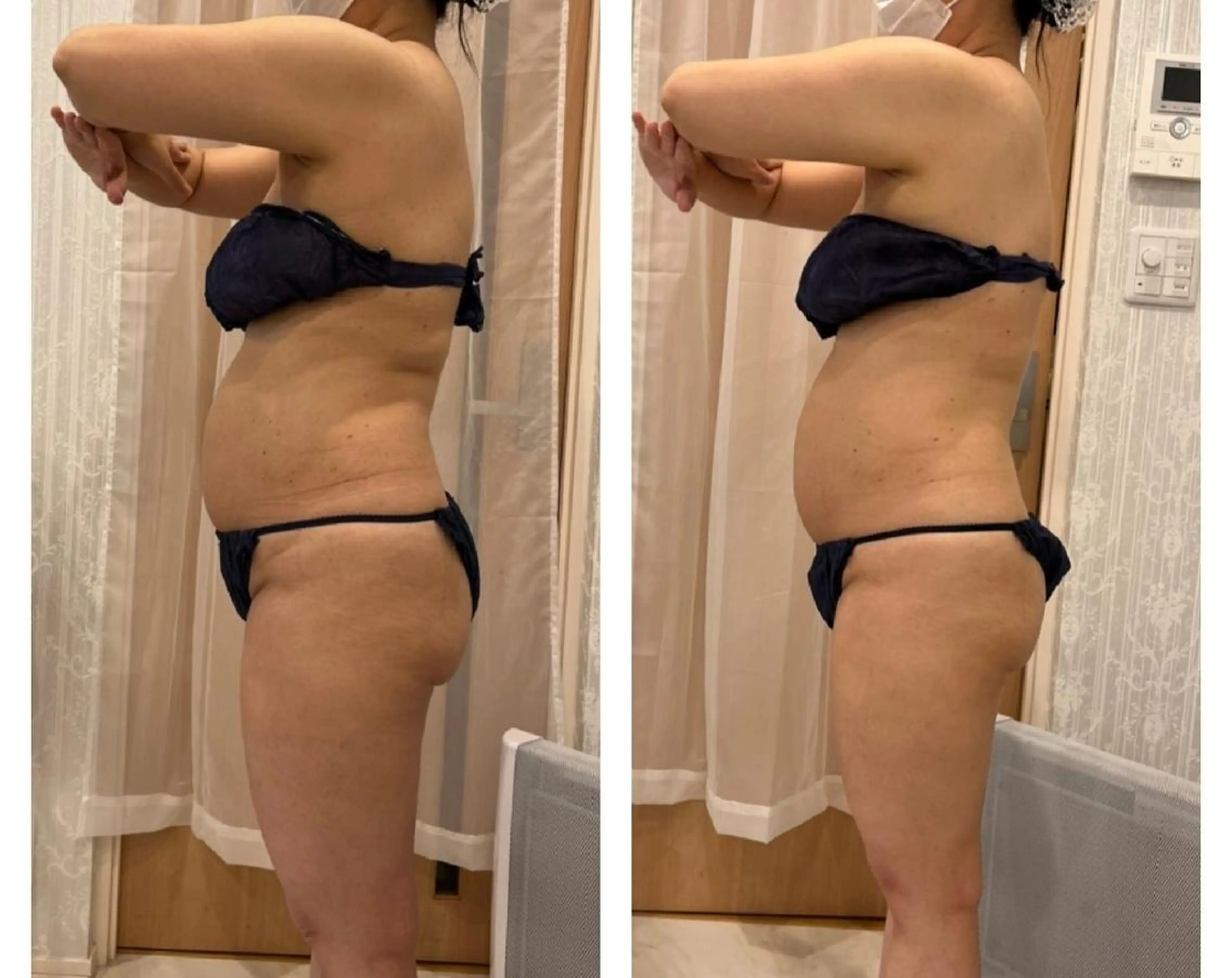 M✨ Hoshi💎✨のエステ・リラクイメージ