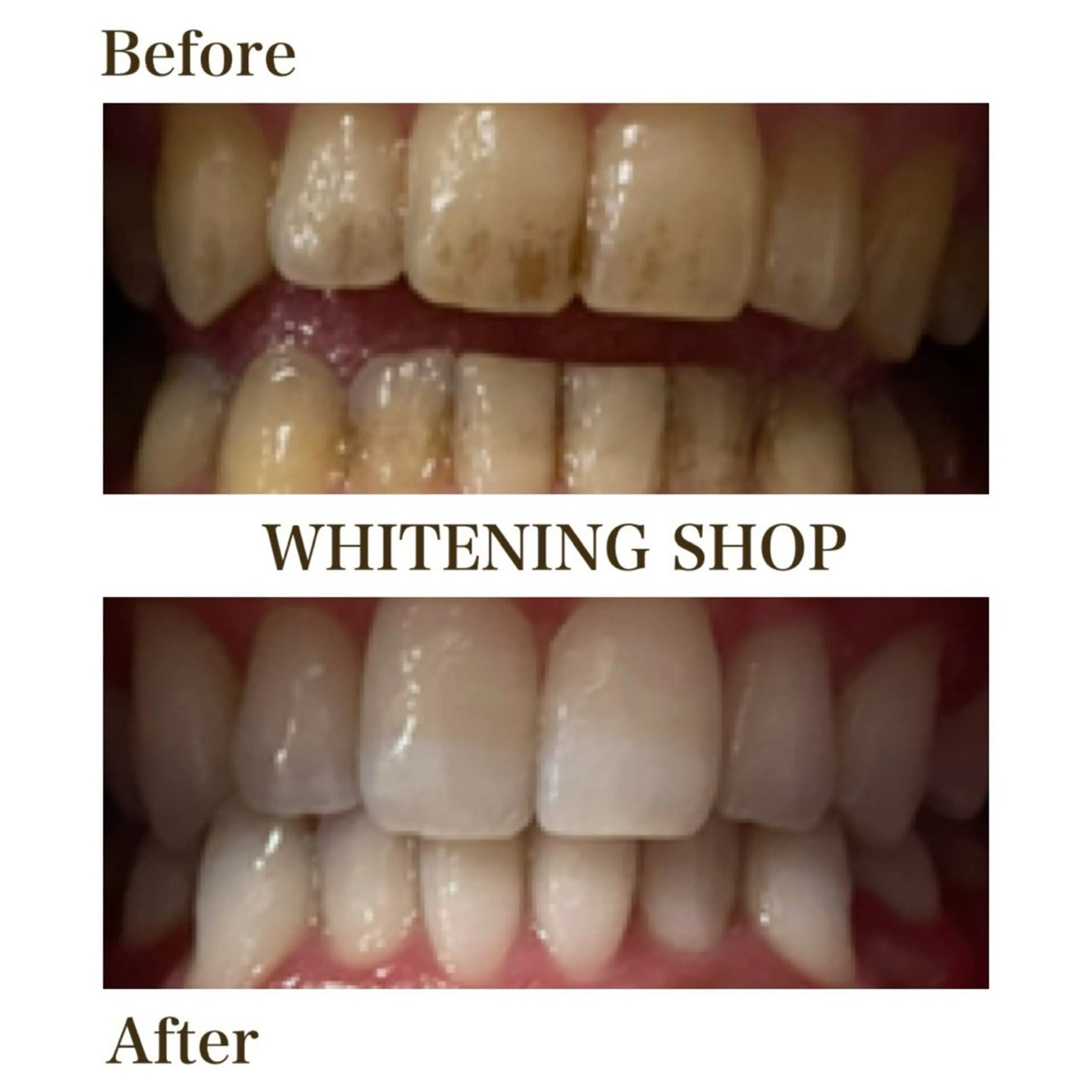 その他 ホワイトニングショップ静岡葵区店所属・ホワイトニング ショップ葵区静岡駅店のその他イメージ