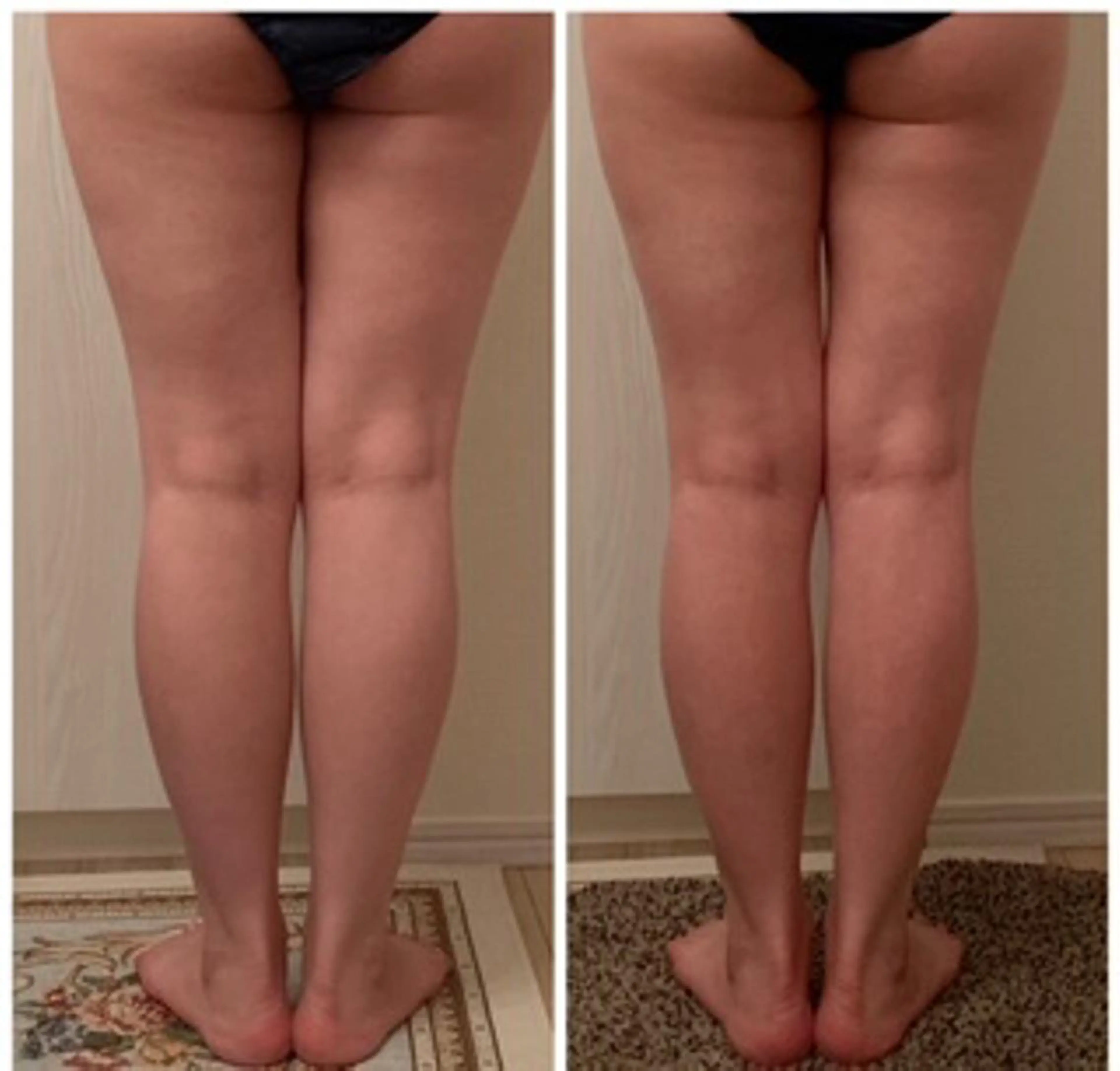 食べながら魅せボディ éclatJua川越のエステ・リラクイメージ