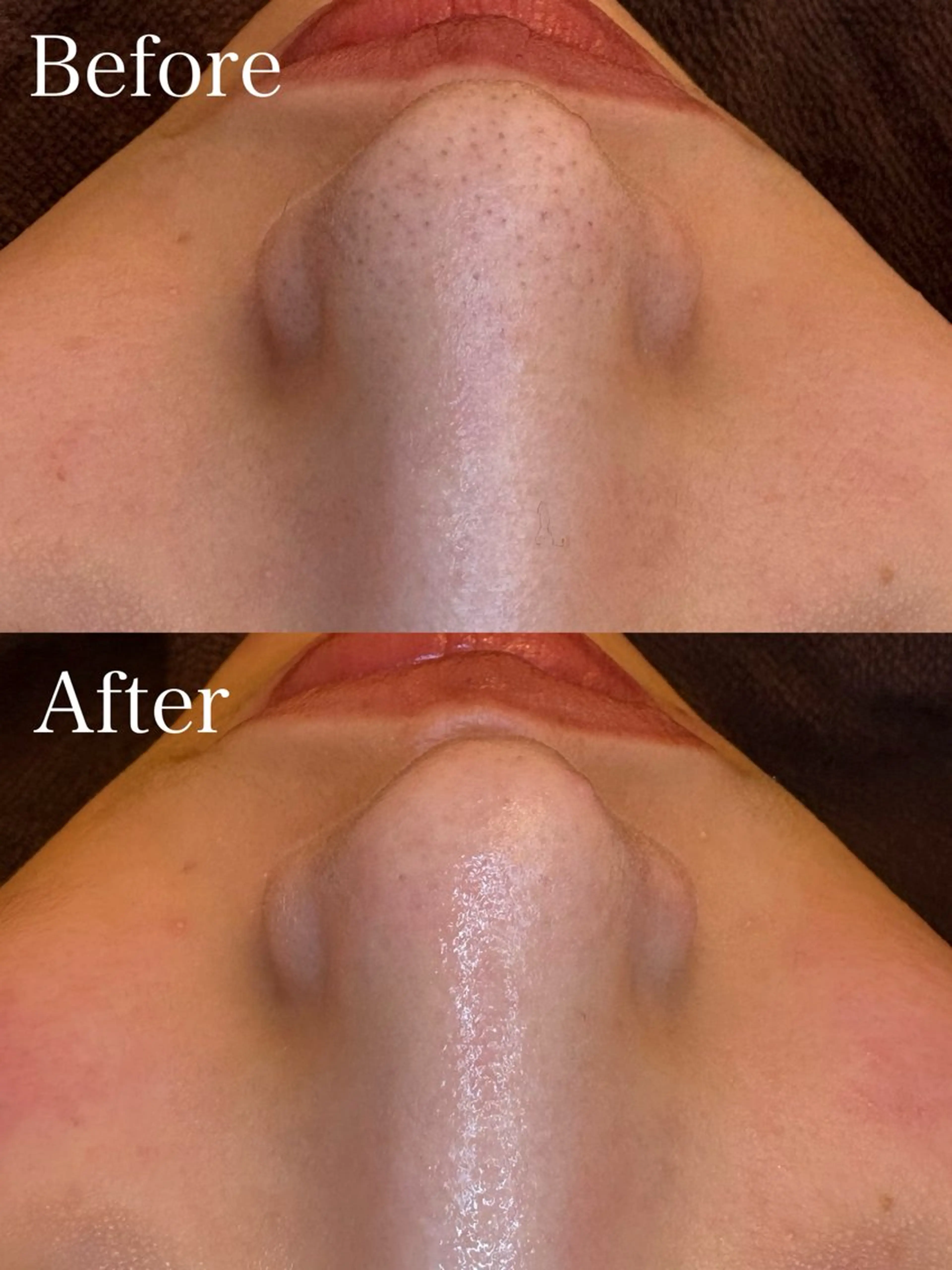 🤍アベシュリ /フェイシャル🤍のエステ・リラクイメージ