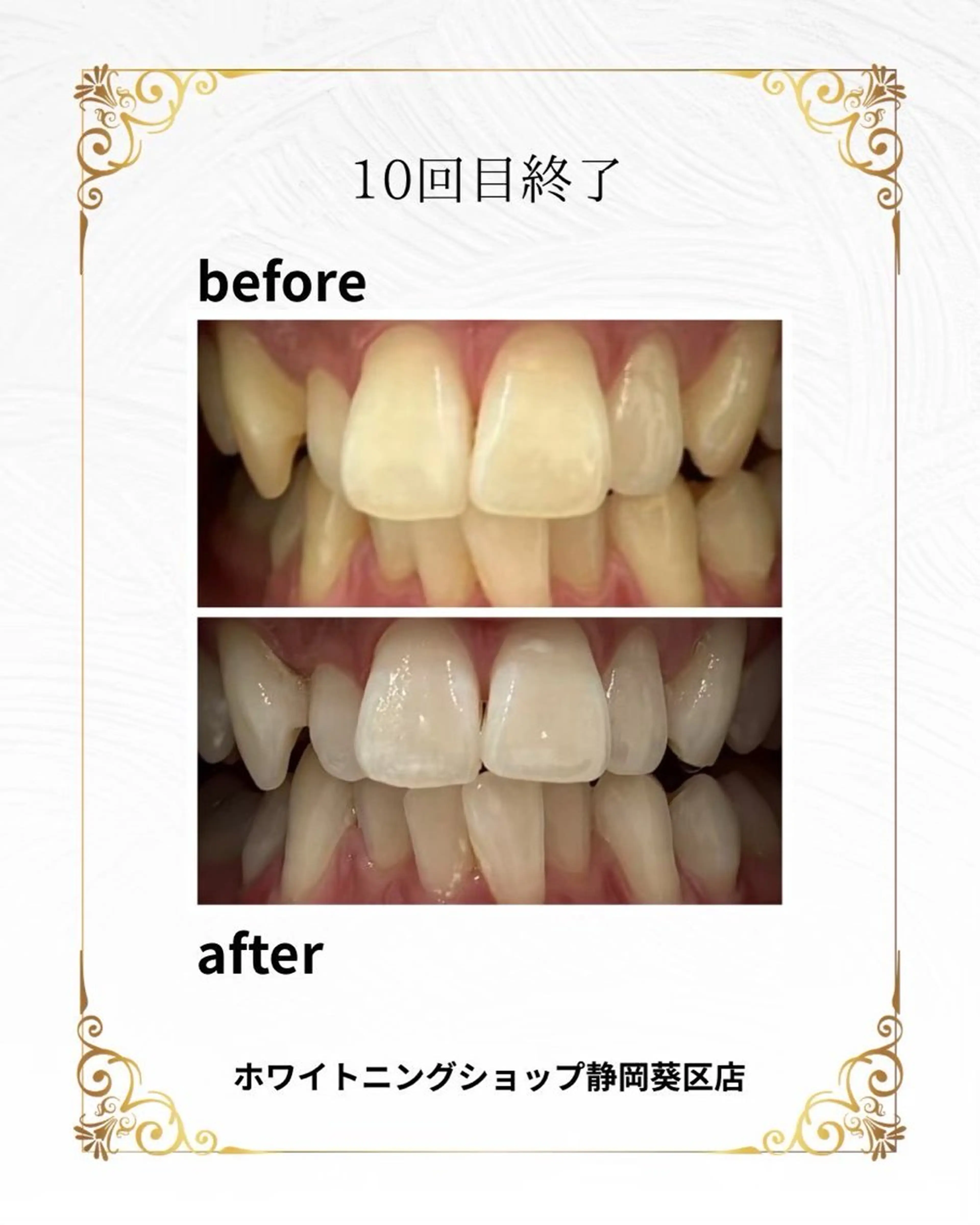 【静岡市にご勤務されている方限定】当店初回セルフホワイトニング40分8980円→0円の写真
