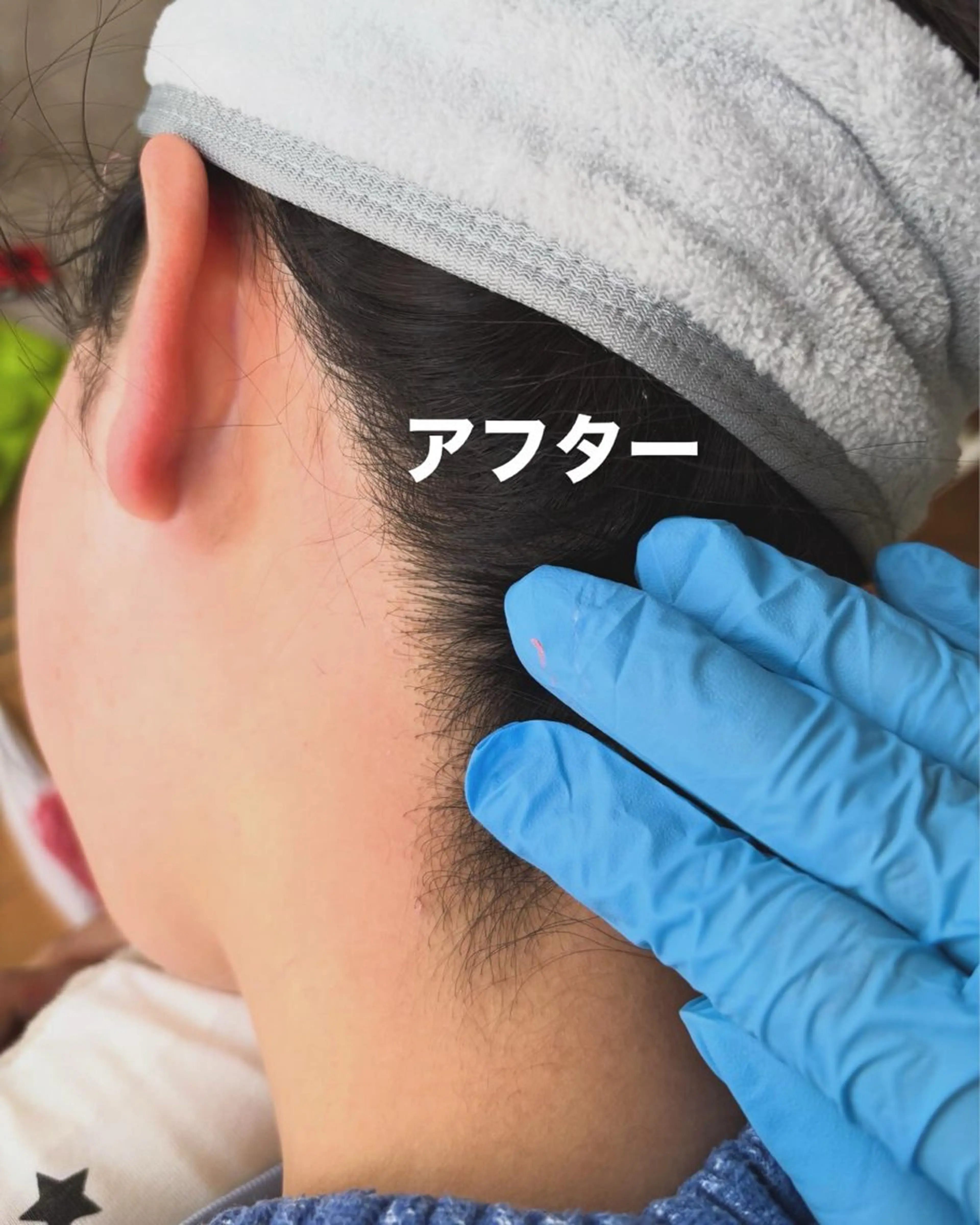 うなじワックス🤍アップヘアが多い方におすすめ🕊️の写真