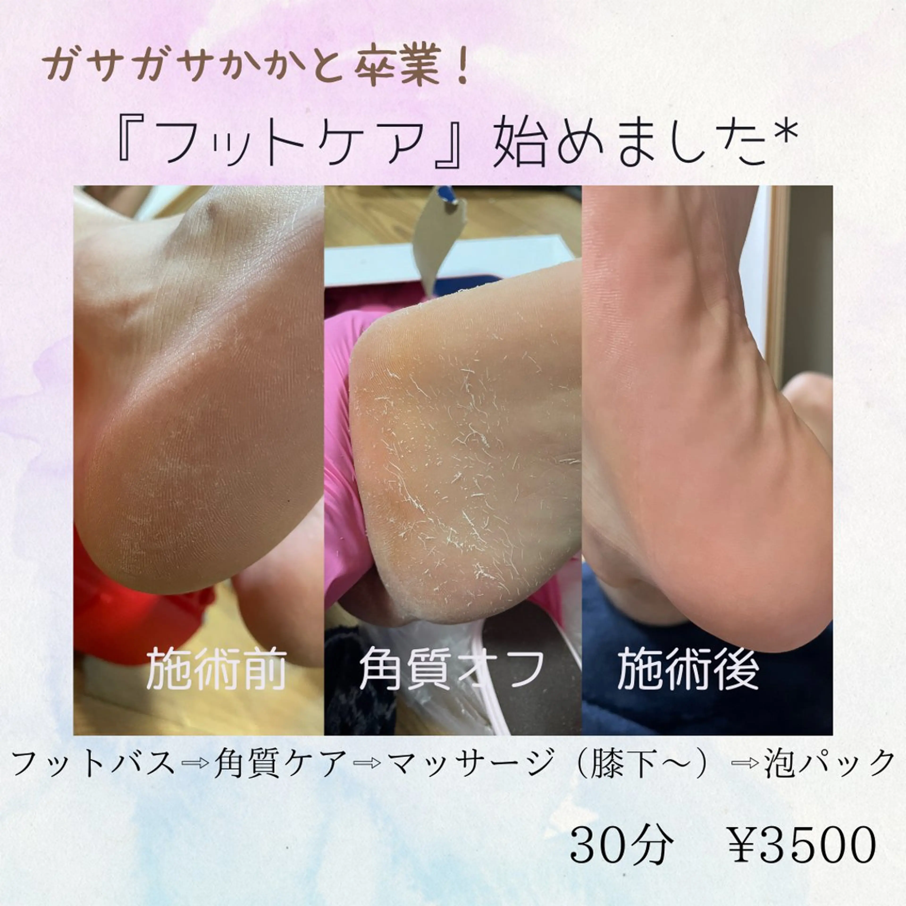 岸和田／久米田 MooMooのエステ・リラクイメージ