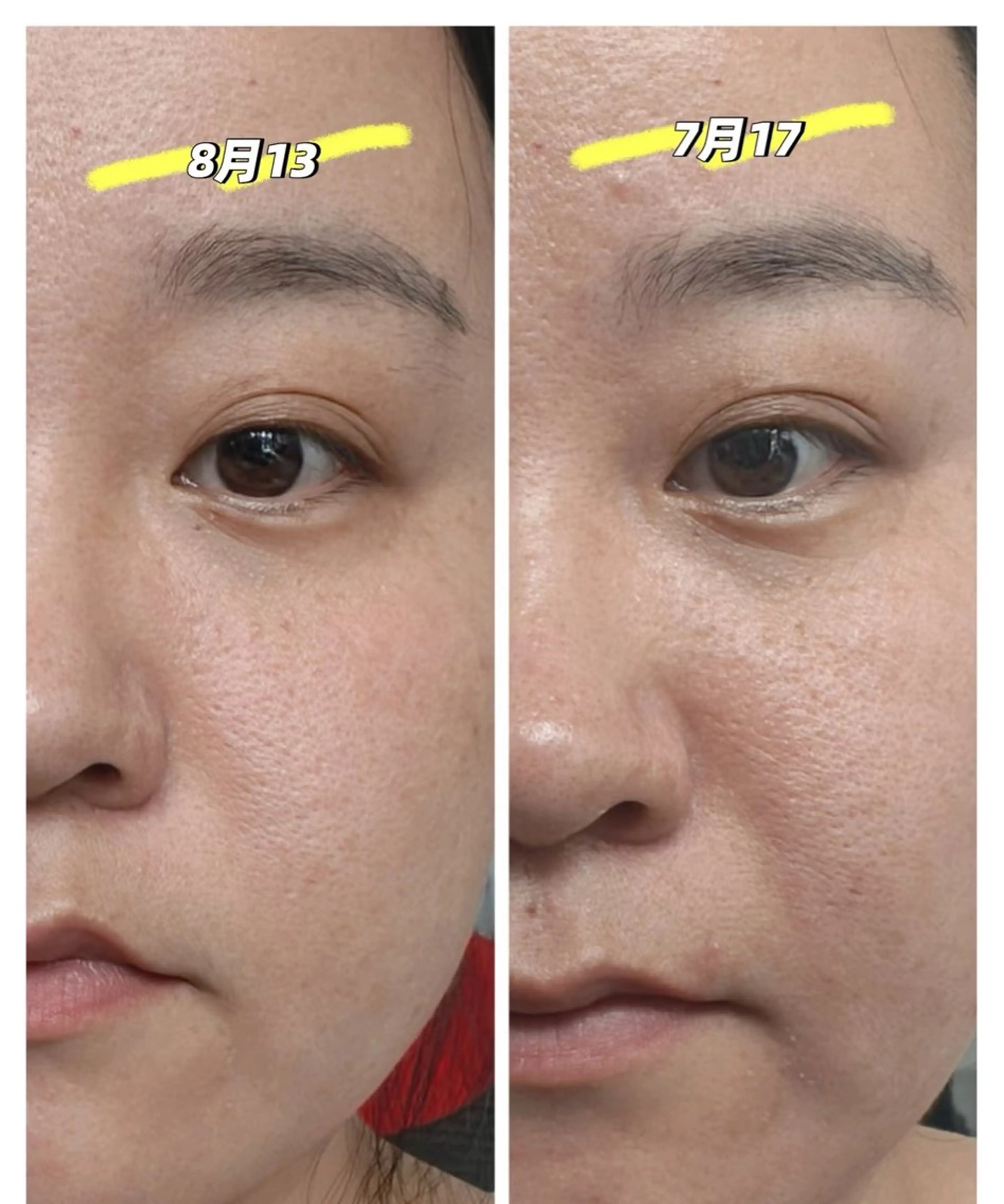 ネイル その他 aliaハーブ水光店 エステティシャン募集のエステ・リラクイメージ