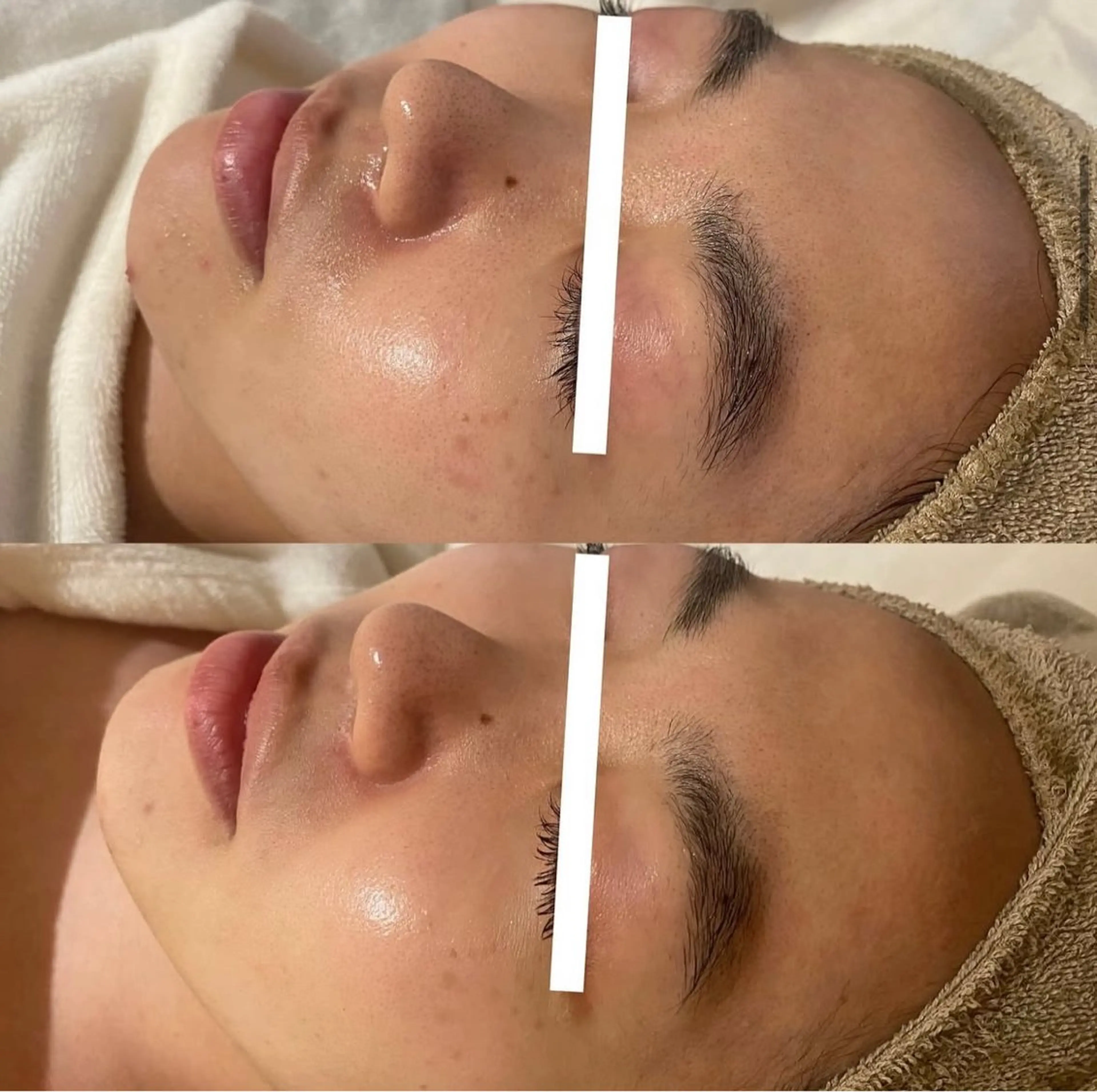 中目黒ハーブピーリン グ🌿ララピールのエステ・リラクイメージ