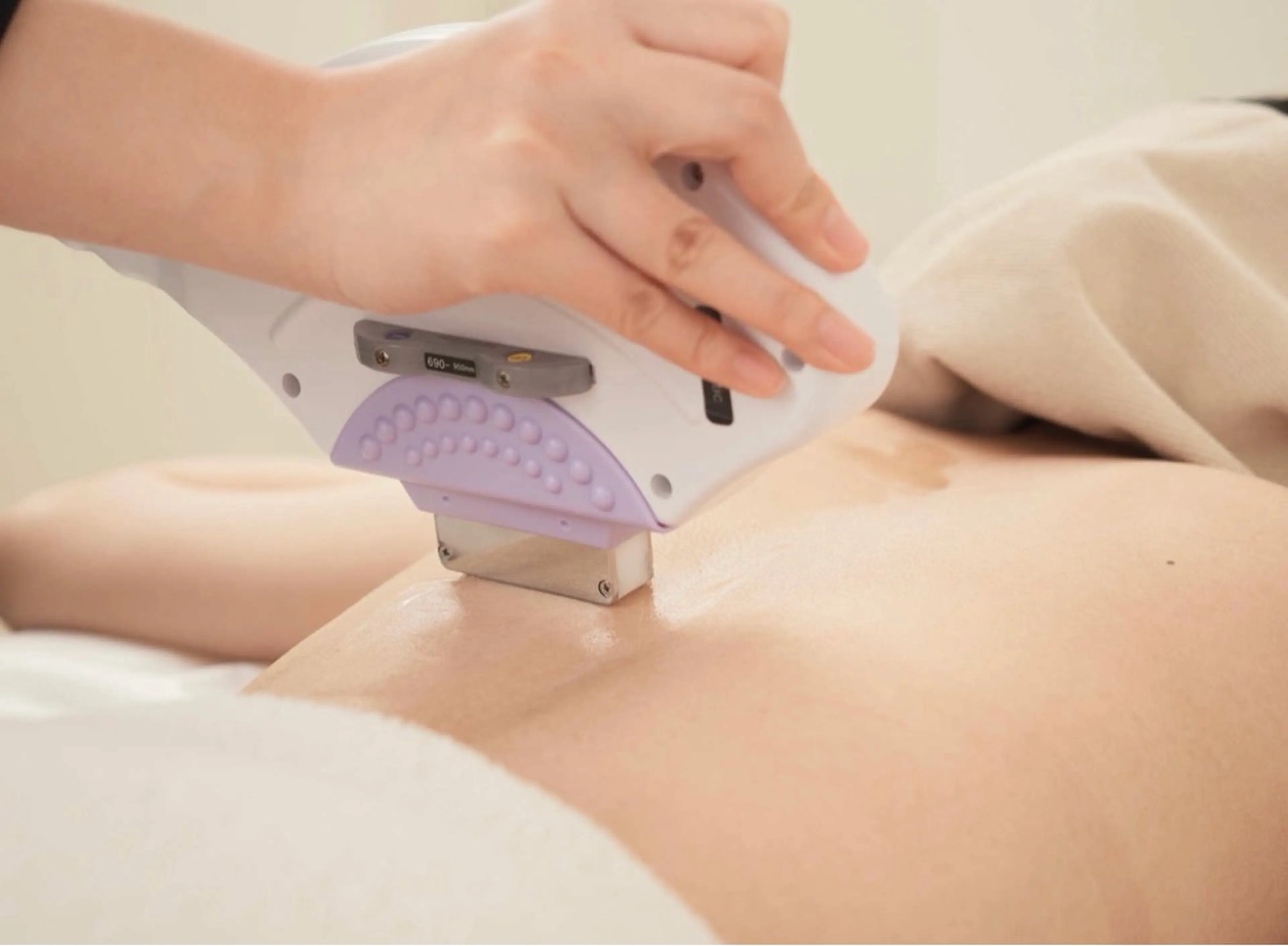 【レディース】全身（顔・VIO込）脱毛　モニター￥20,000→￥6,600の写真