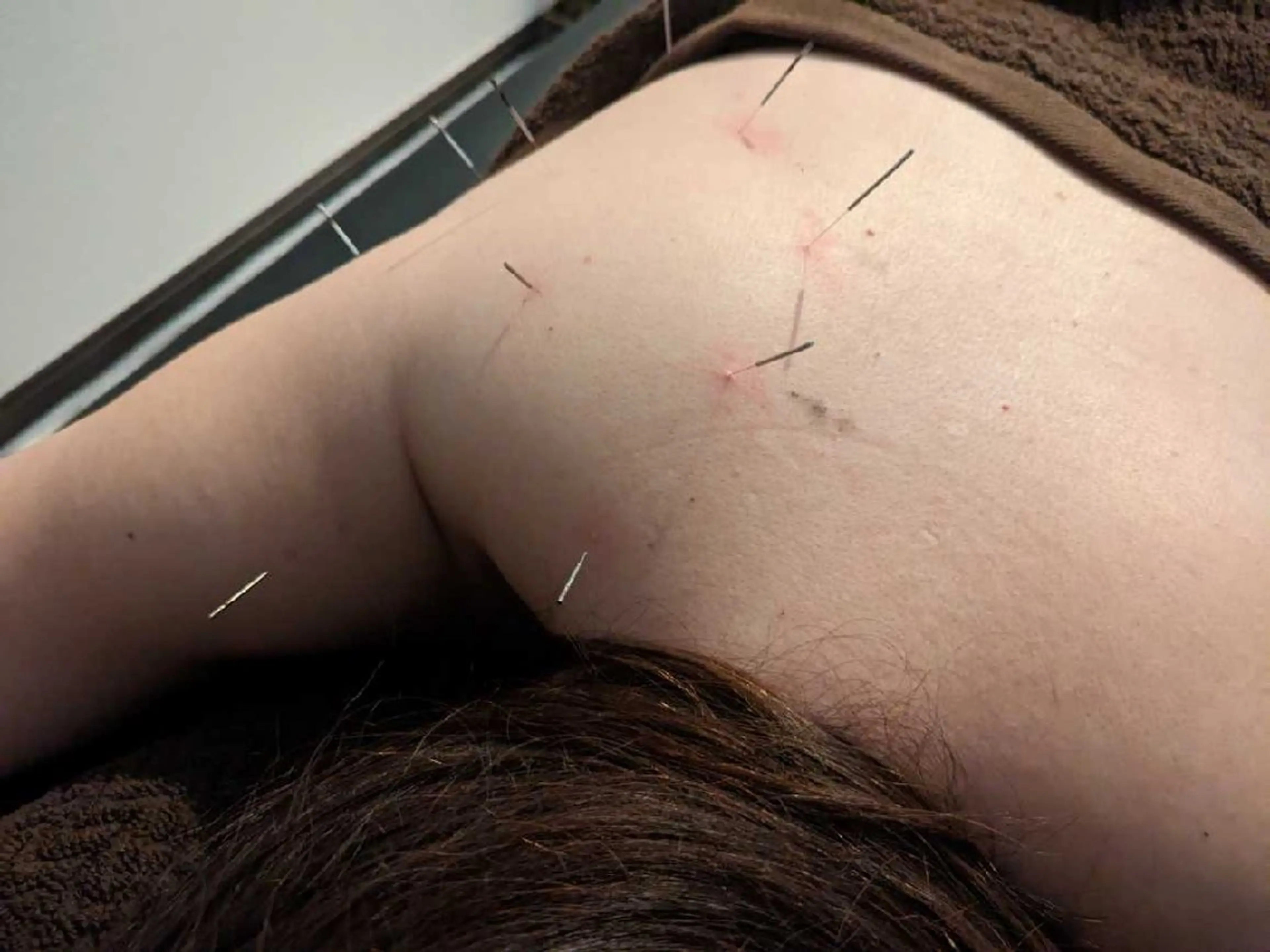 エステ リラク KANWA鍼灸院所属・KANWA 鍼灸院のエステ・リラクイメージ