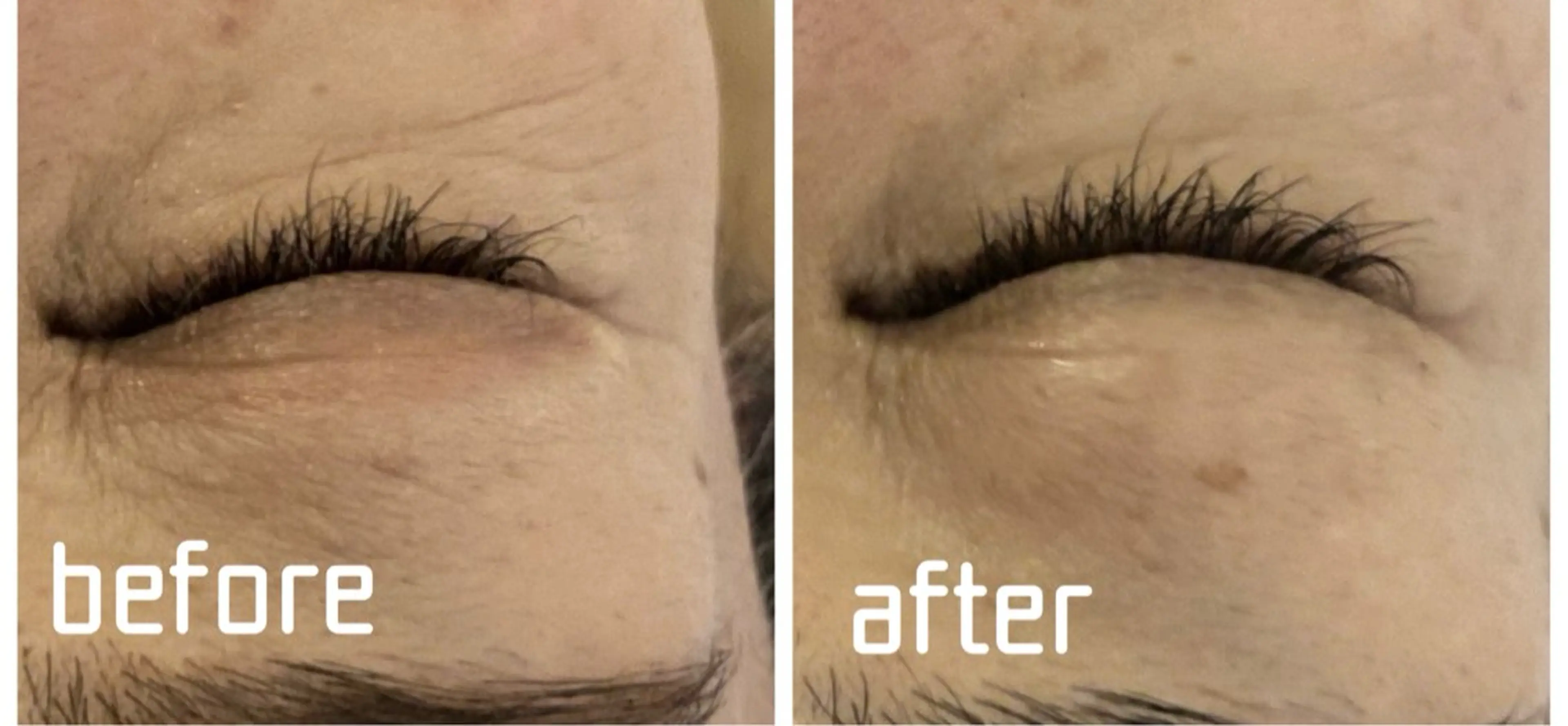 今なら50%off❗️写真写りが怖くない目元へ｜しわ改善＆潤いリフトアイフェイシャル90分の写真