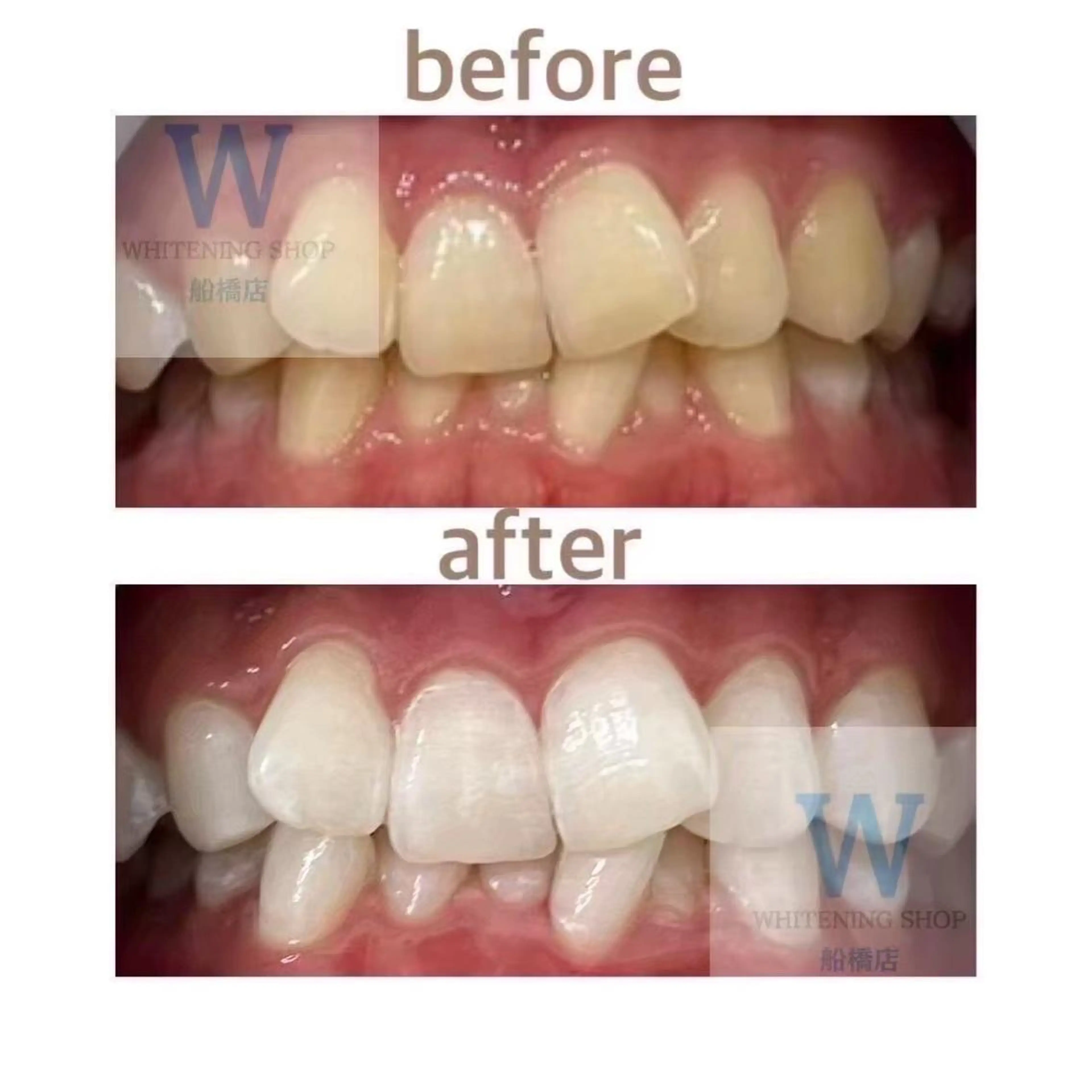 エステ リラク ホワイトニング ショップ船橋店🦷のエステ・リラクイメージ