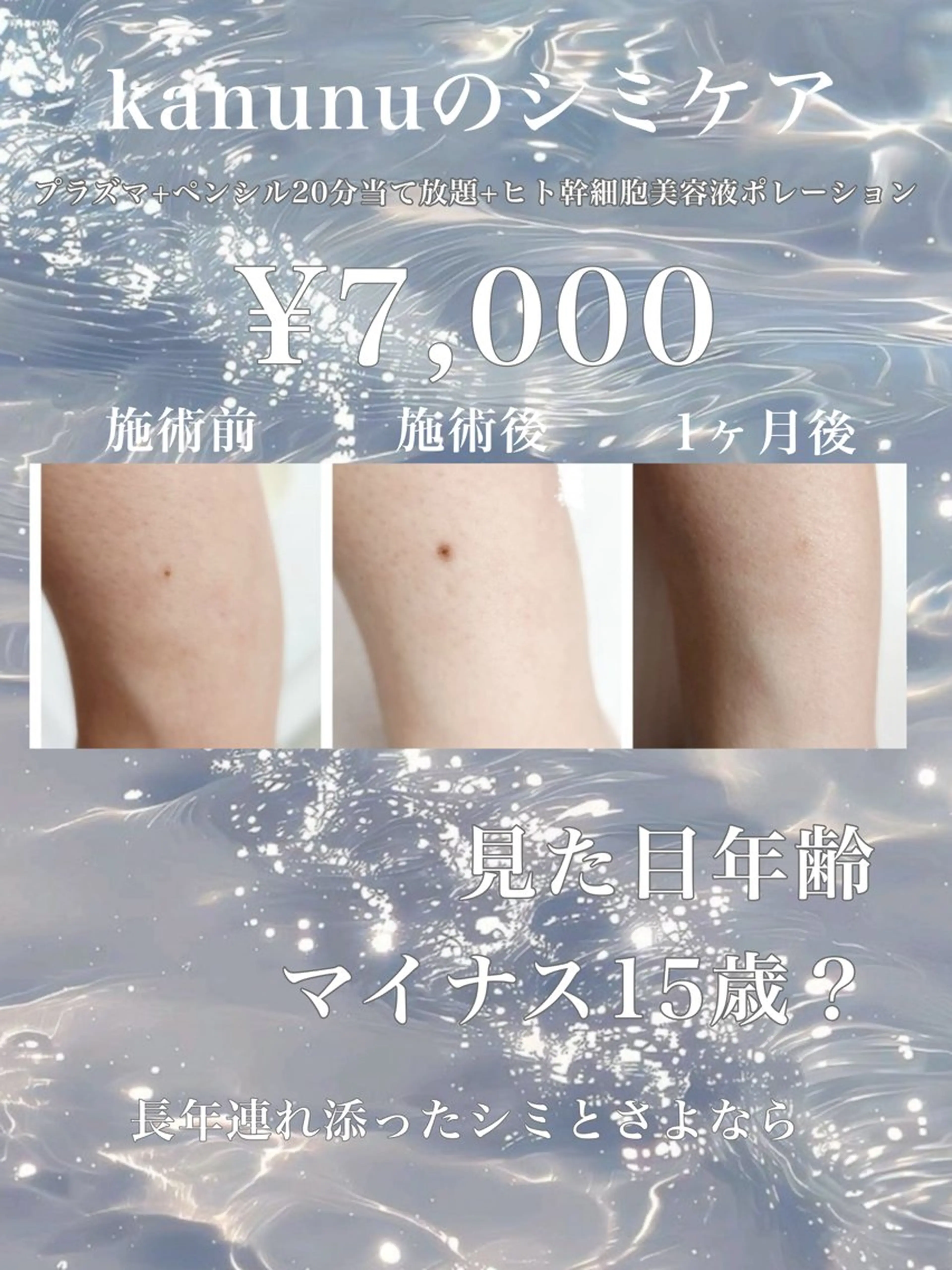 韓国美容×肌管理 kanunu鶴橋店のエステ・リラクイメージ