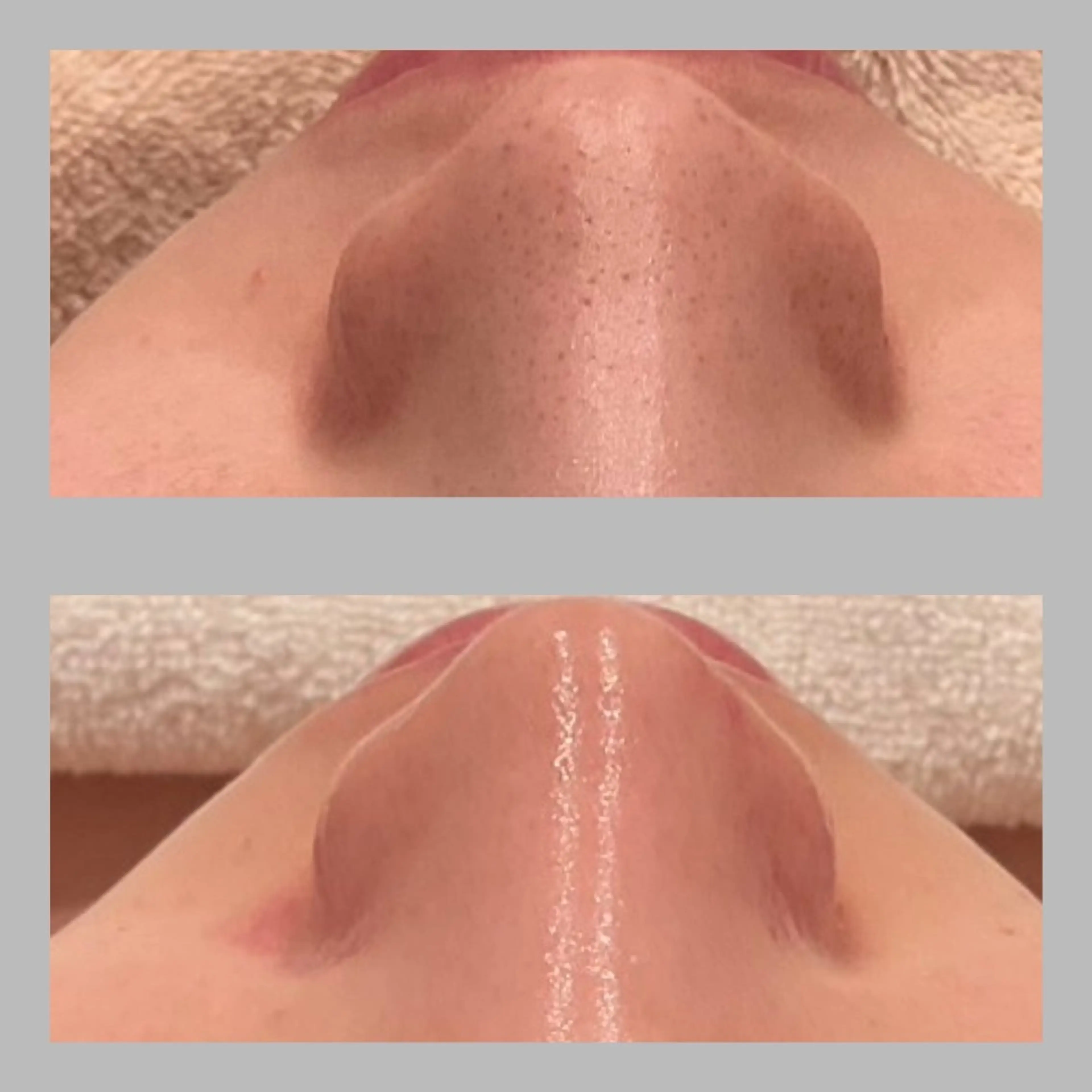 エステ ベル チェリカ 三城のエステ・リラクイメージ