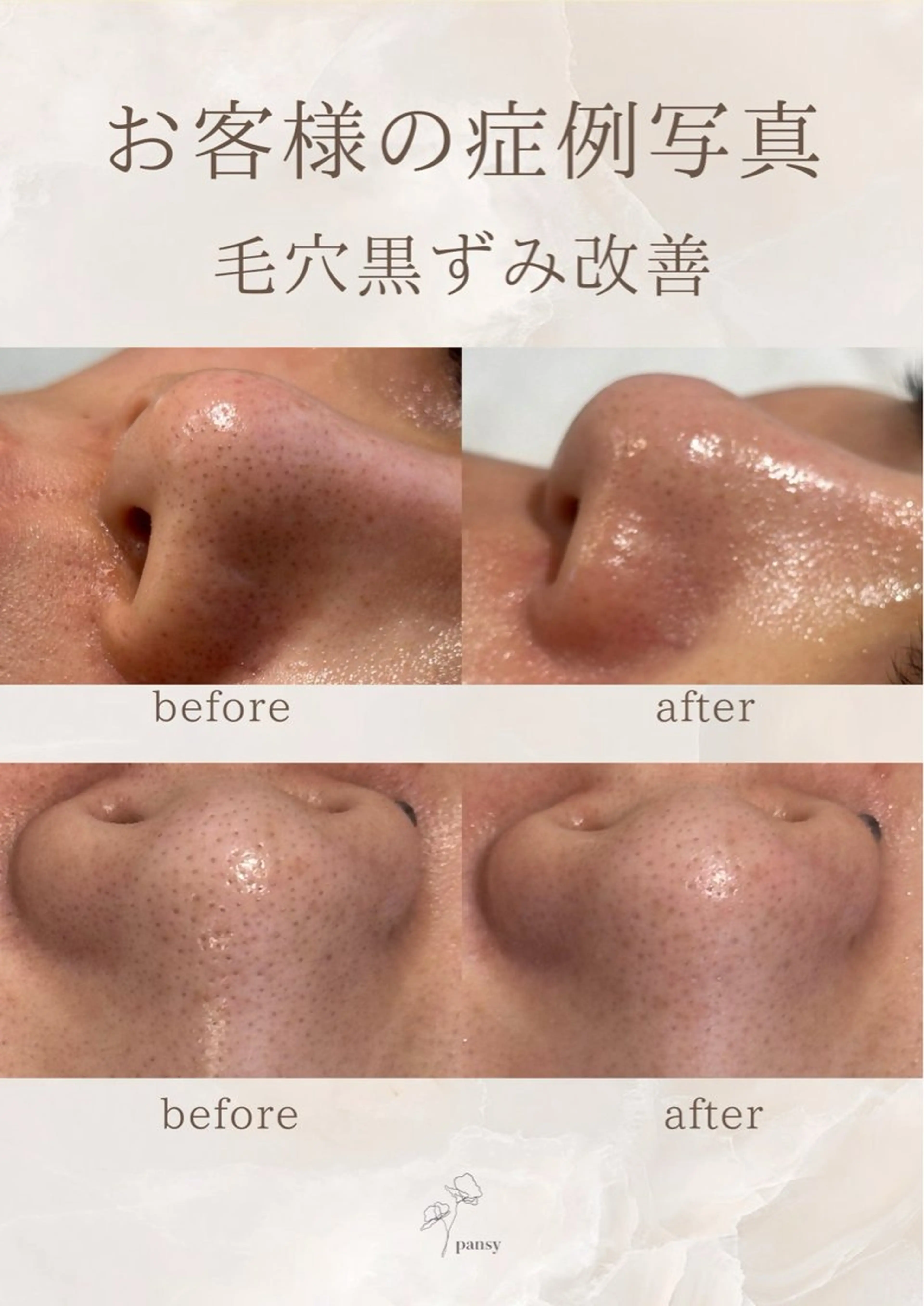 エステ pansy フェイシャルエステのエステ・リラクイメージ