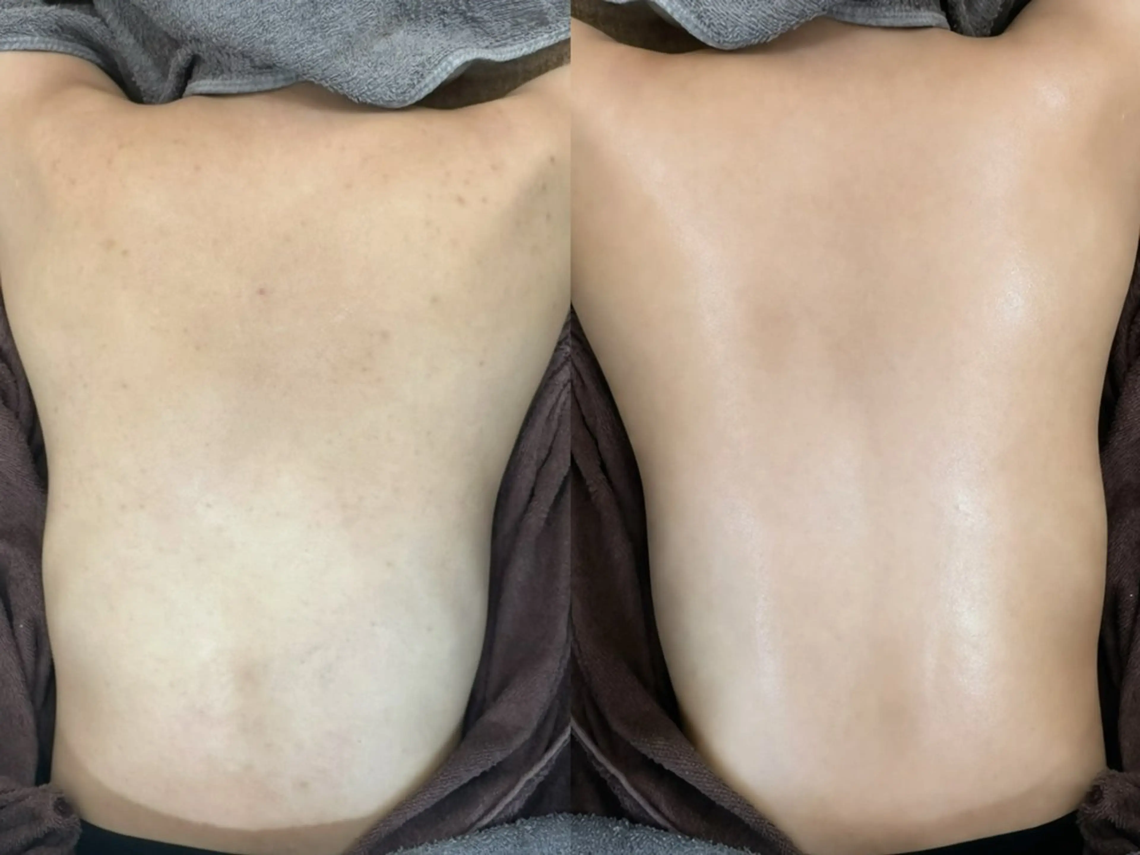 エステ 艶肌デトックス🫧 Samiraのエステ・リラクイメージ