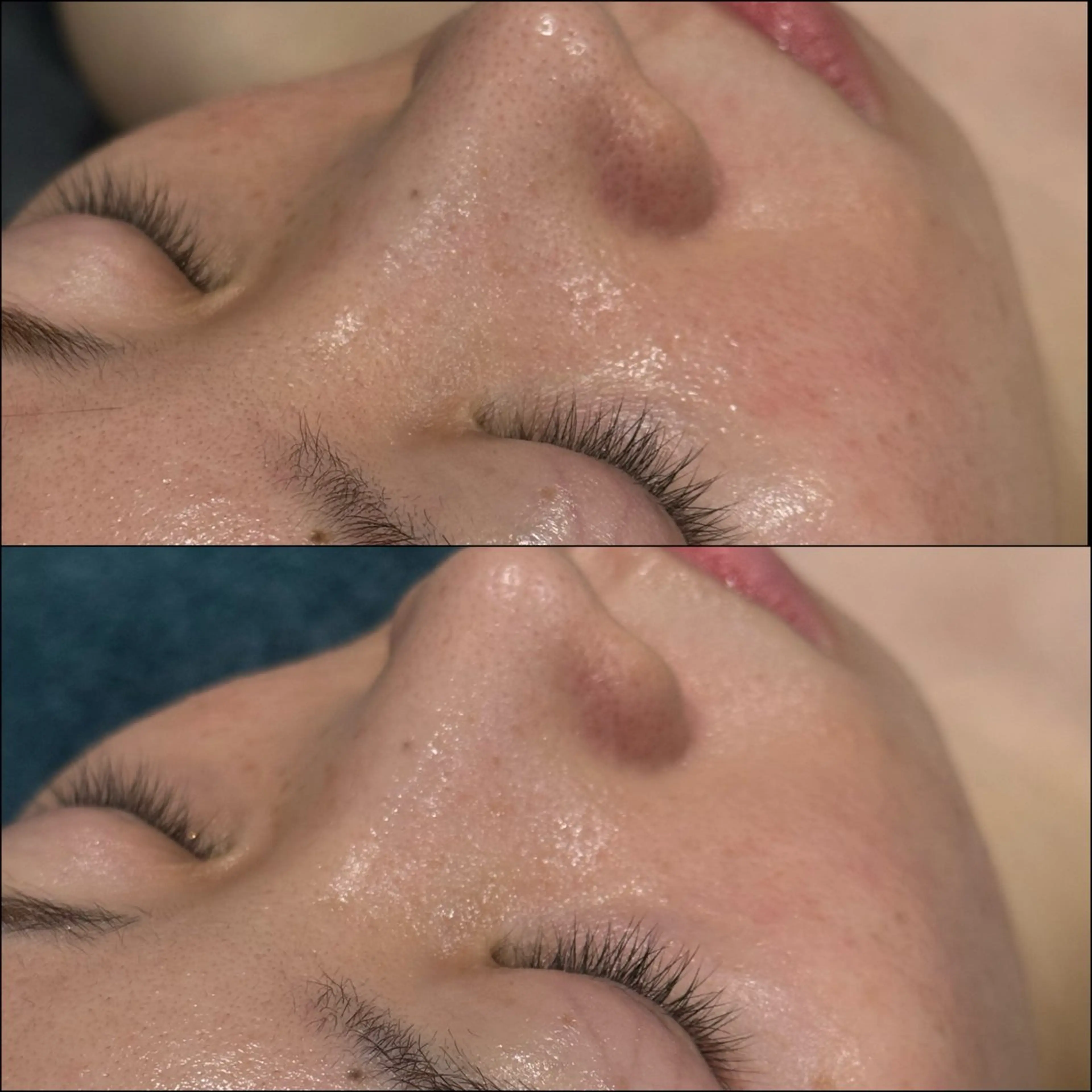 LiZA エステティックサロンのエステ・リラクイメージ