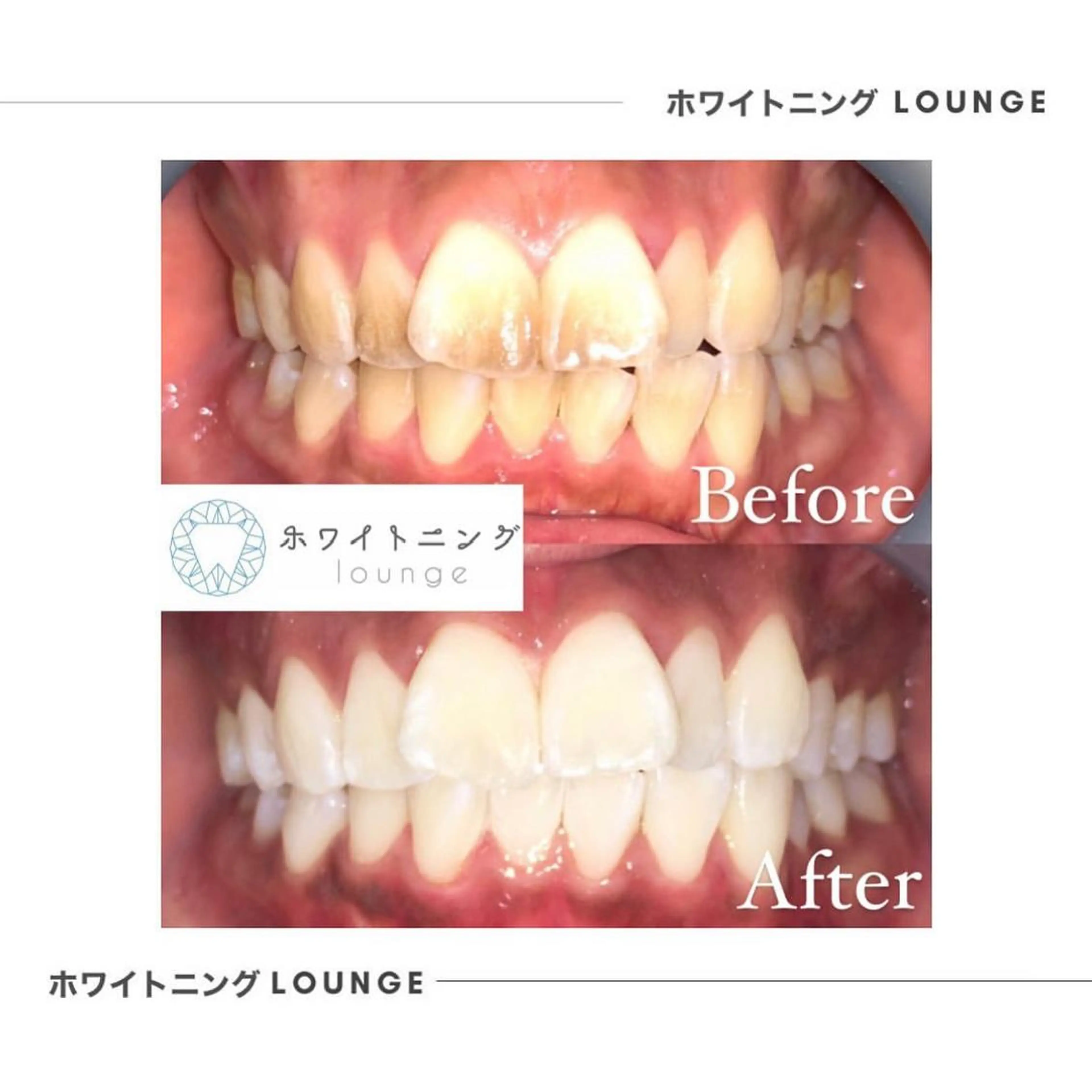ホワイトニング Lounge横須賀のエステ・リラクイメージ